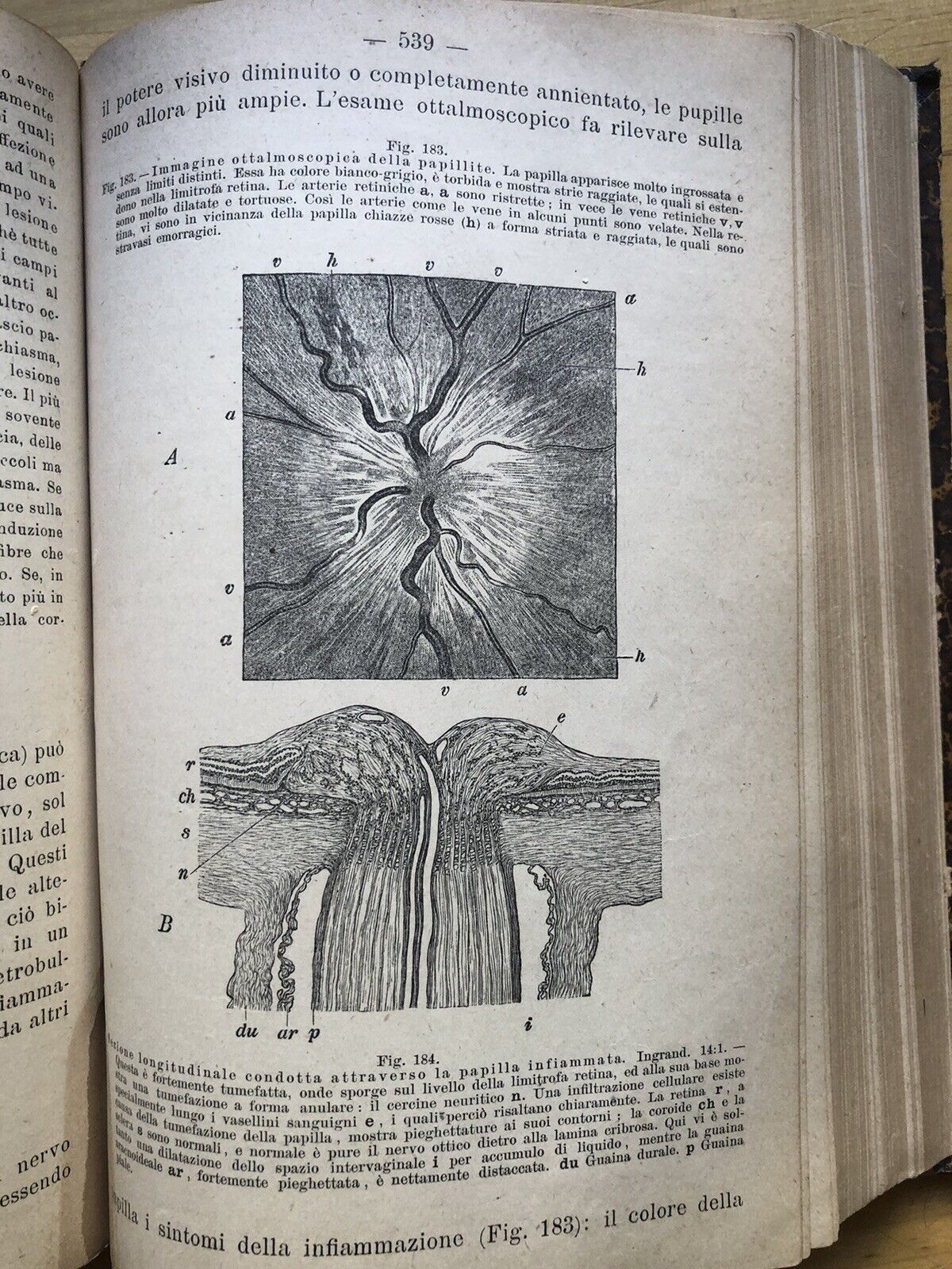 Trattato di oftalmologia - Fuchs