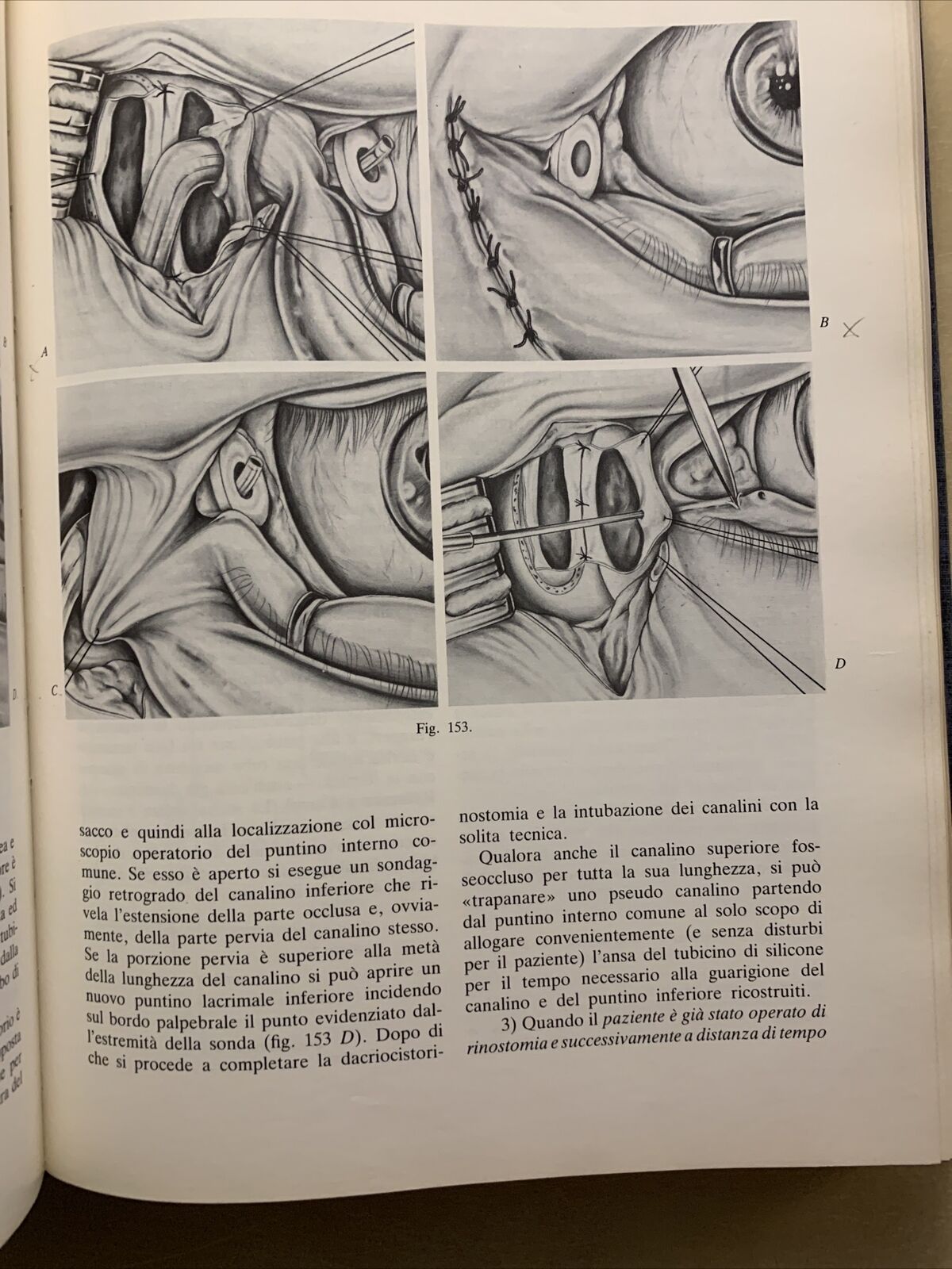 Tecnica Chirurgica. Chirurgia Oculistica UTET volume 10 - 1984 #