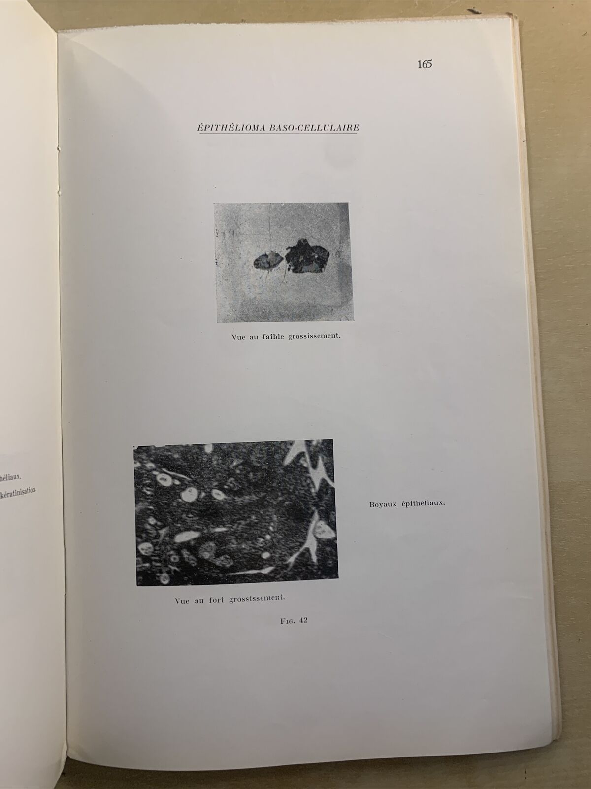 NOUVELLES TECHNIQUES DE LABORATOIRE EN OPHTALMOLOGIE - J. B. BARON, CABAU #