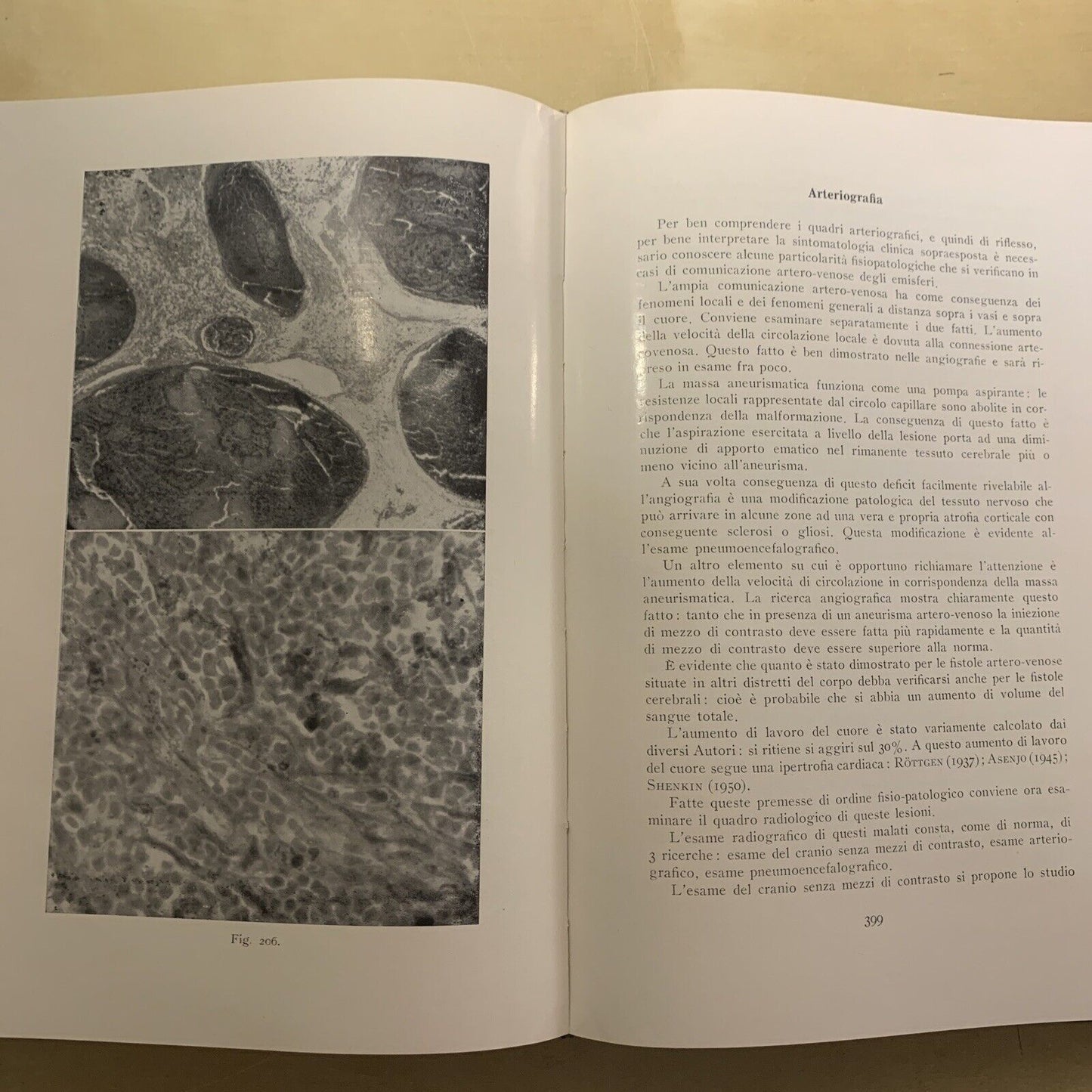 ANGIOGRAFIA CEREBRALE - MARIO MILLETTI, VOLUME PRIMO. LUIGI PARMA 1959