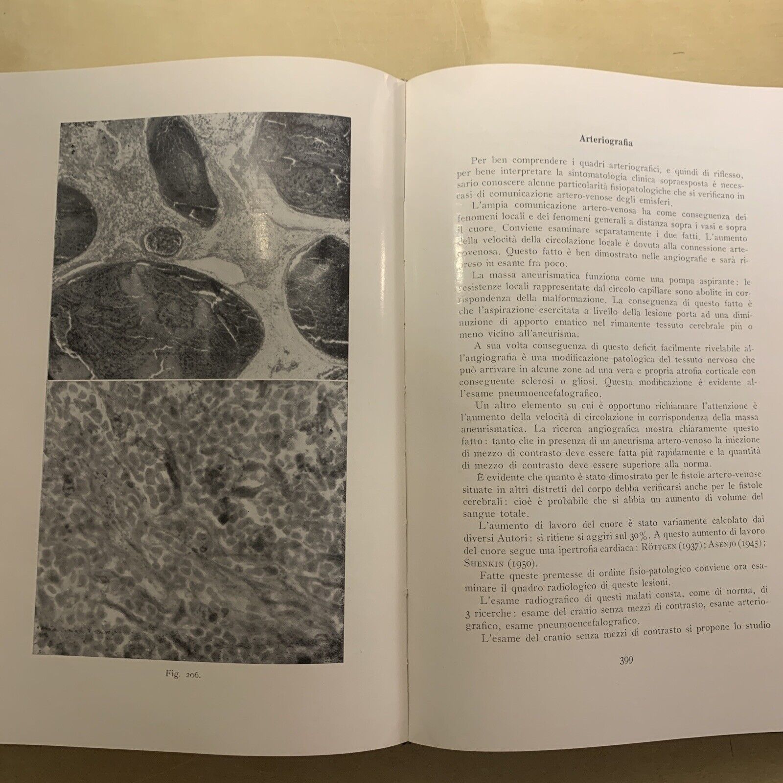 ANGIOGRAFIA CEREBRALE - MARIO MILLETTI, VOLUME PRIMO. LUIGI PARMA 1959
