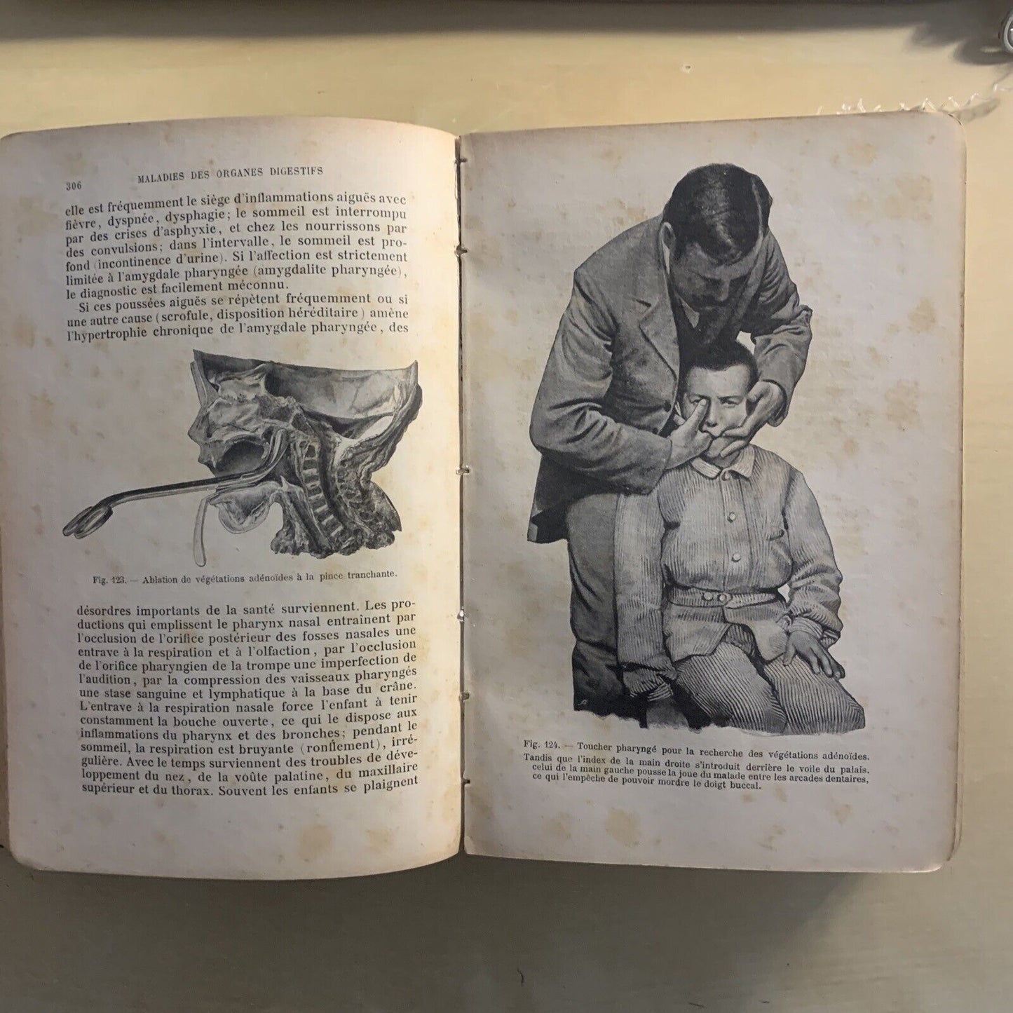 ATLAS MANUEL MALADIES DES ENFANTS. Hecker Trump Apert. Baillière & Fils 1906 #