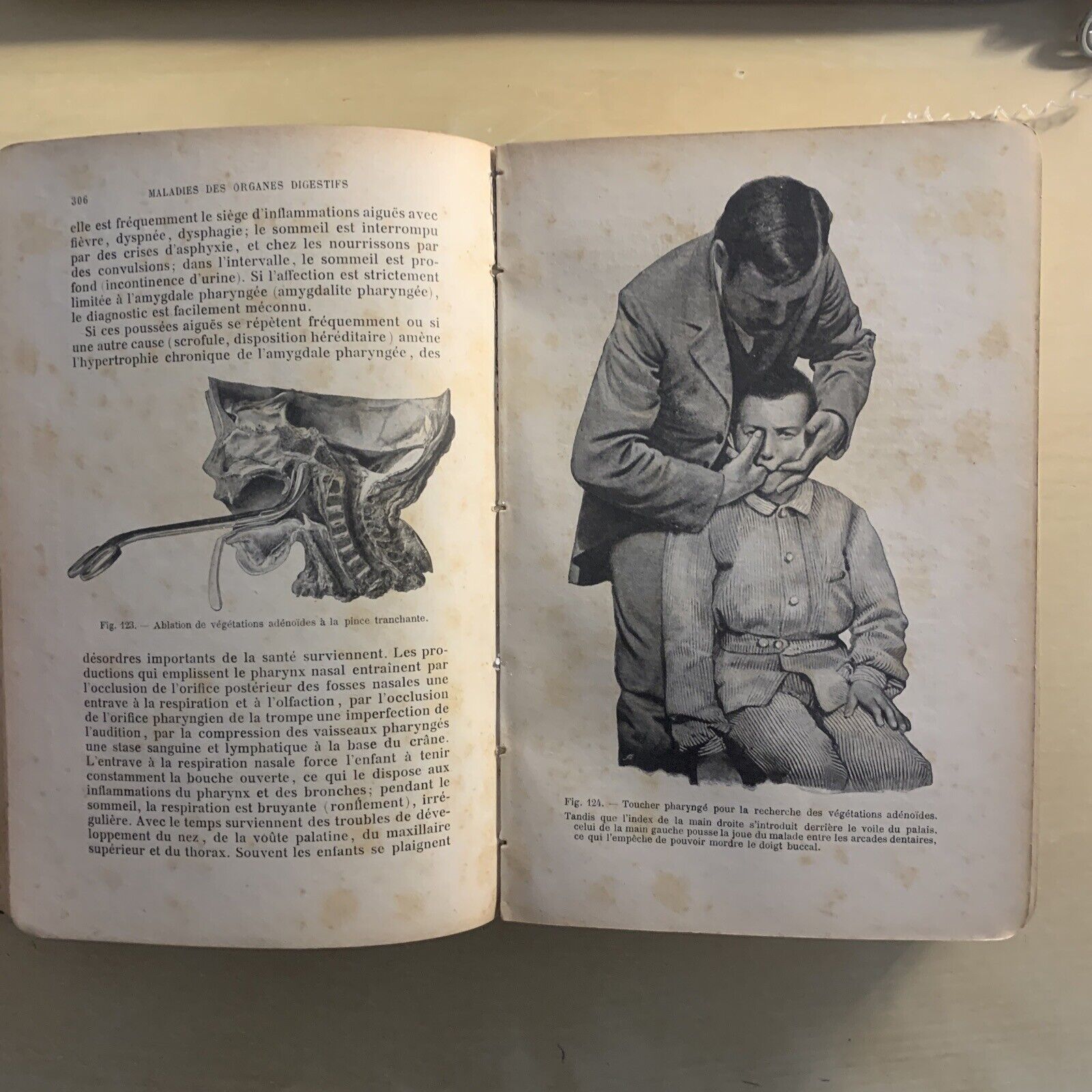 ATLAS MANUEL MALADIES DES ENFANTS. Hecker Trump Apert. Baillière & Fils 1906 #