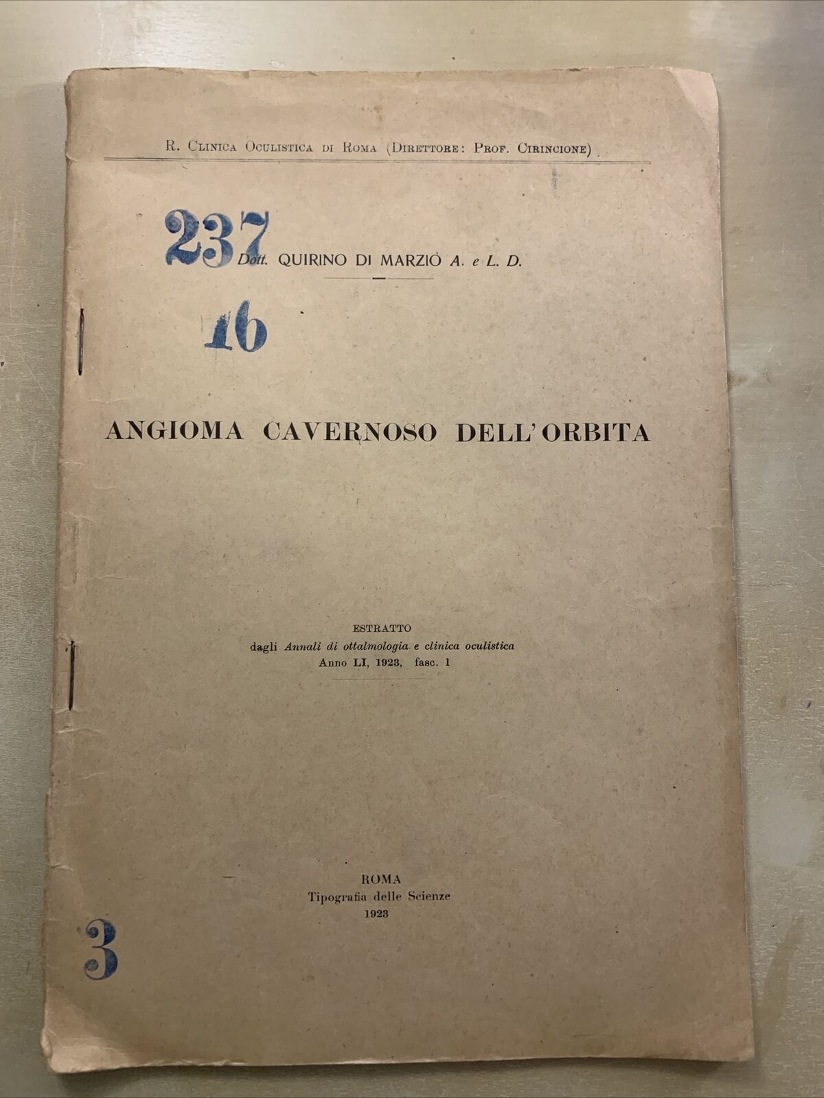 ANGIOMA CAVERNOSO DELL'ORBITA - Quirino di Marzio. Oculistica Oftalmologia 1923
