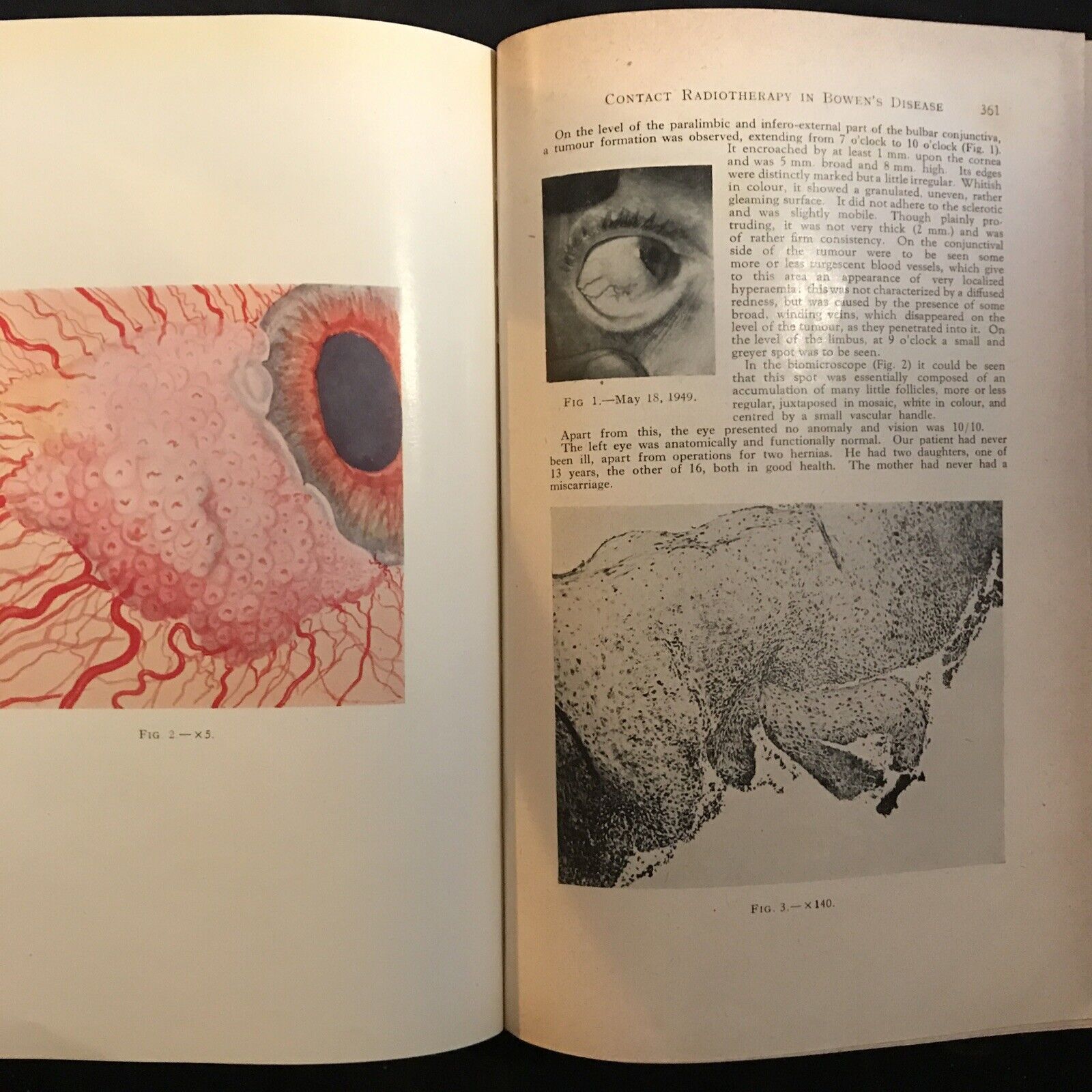 BRITISH JOURNAL OF OPHTHALMOLOGY oftalmologia, vol. XXXIV 1950 - S. Duke-Elder