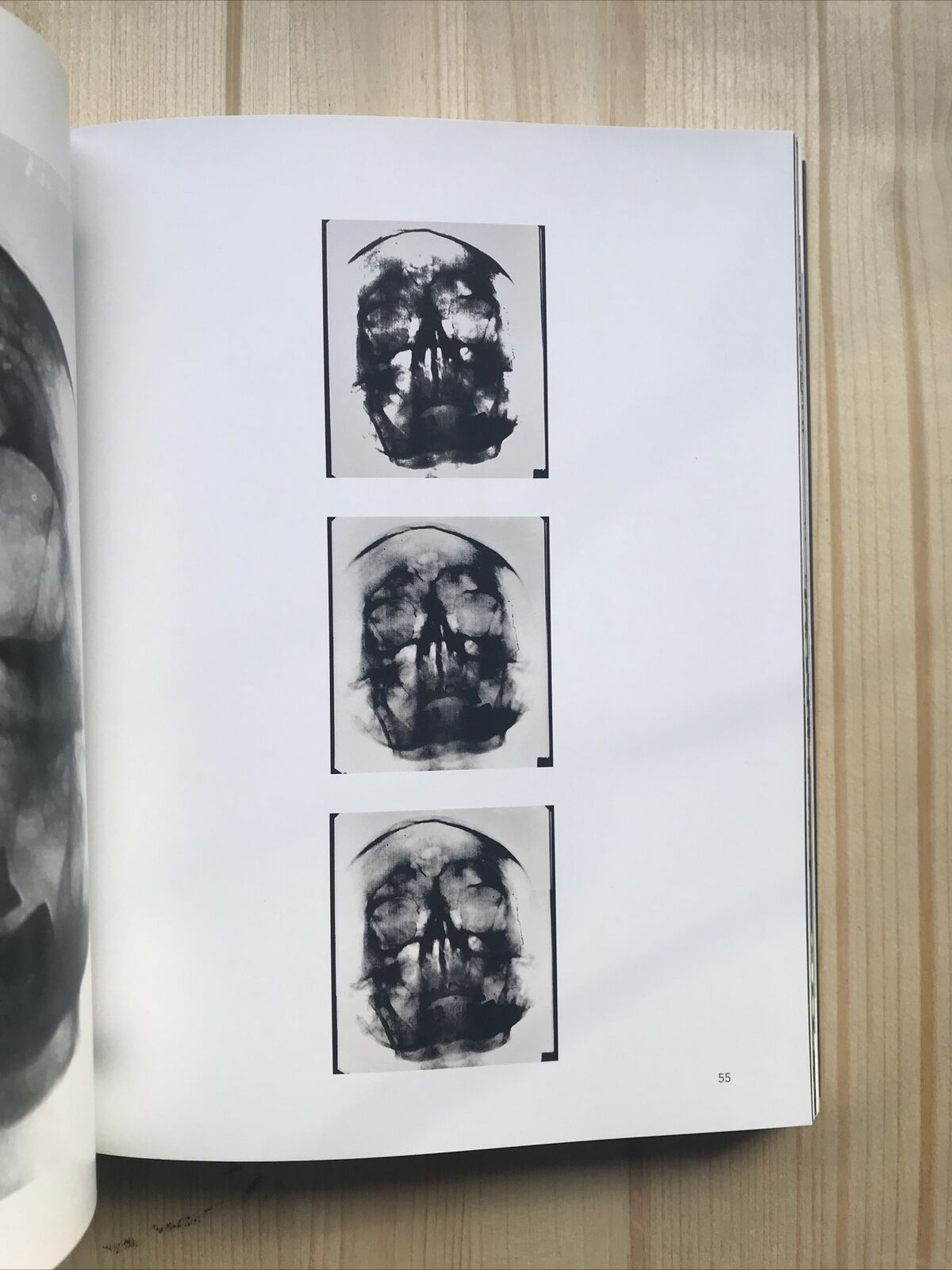 ANTONELLO FRESU - Der Körper, Mostra di Carpi Palazzo del Pio 2019. G. Demuro