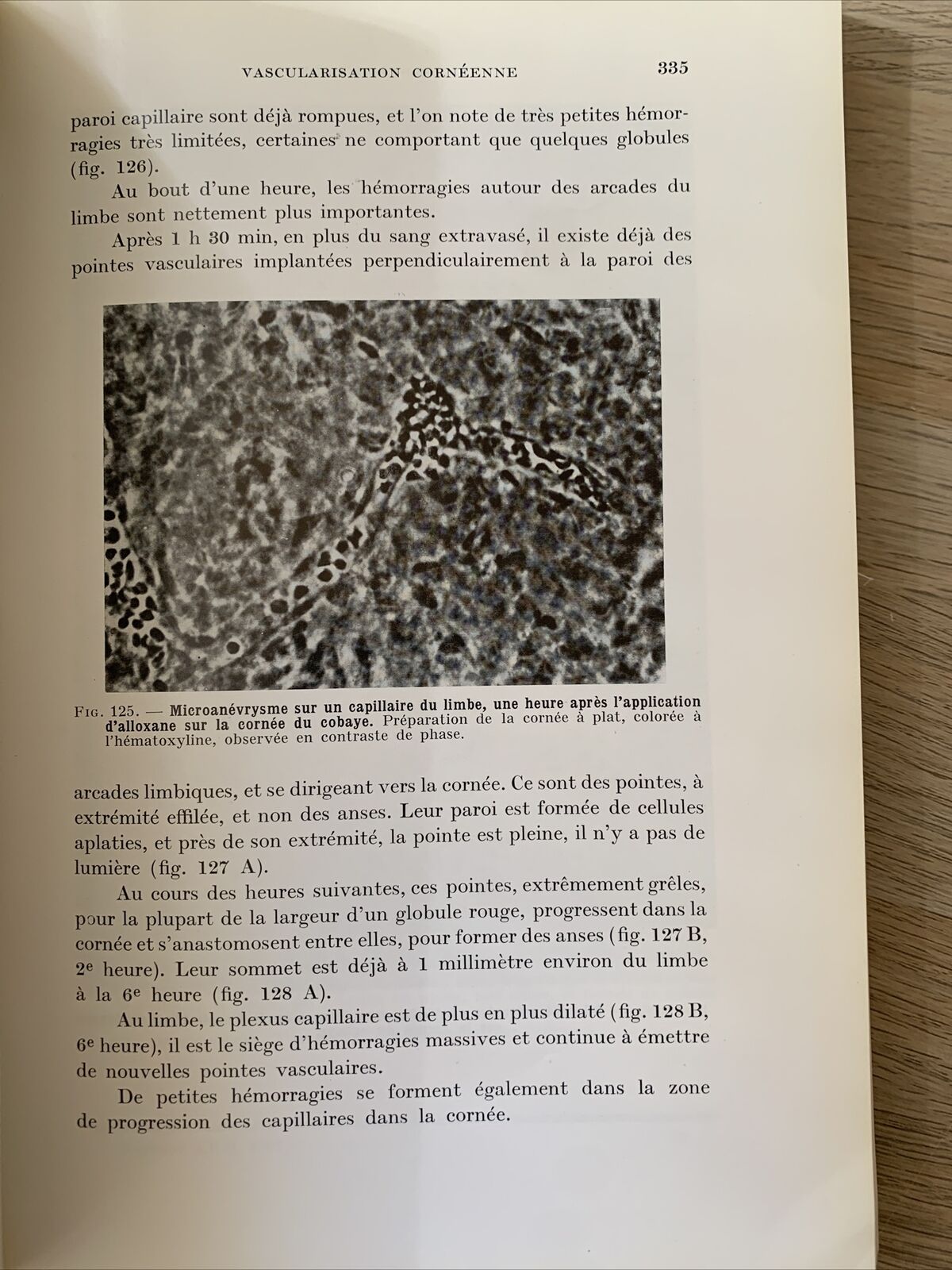La Transparence de la Cornée, les Mécanismes de ses Altérations. Payrau 1967 #