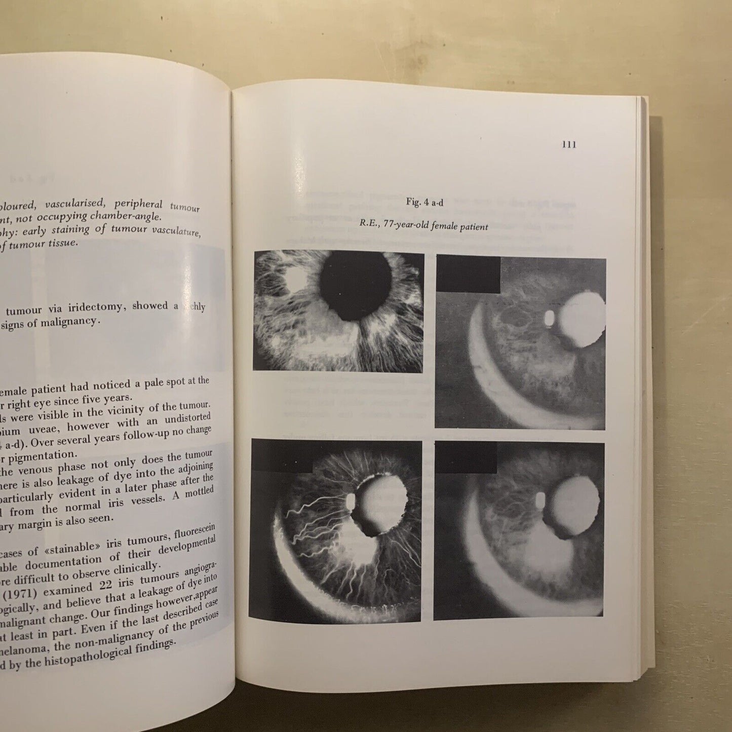 SIMPOSIO INTERNAZIONALE SULL'UVEA. SYMPOSIUM INTERNATIONAL SUR L'UVÉE. PAVESE