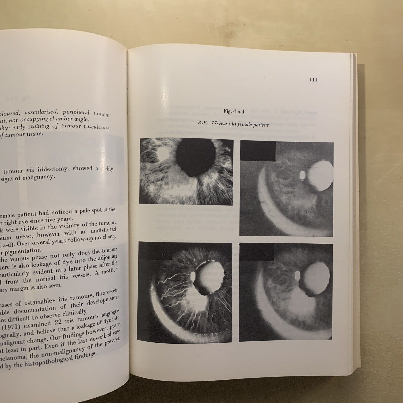 SIMPOSIO INTERNAZIONALE SULL'UVEA. SYMPOSIUM INTERNATIONAL SUR L'UVÉE. PAVESE