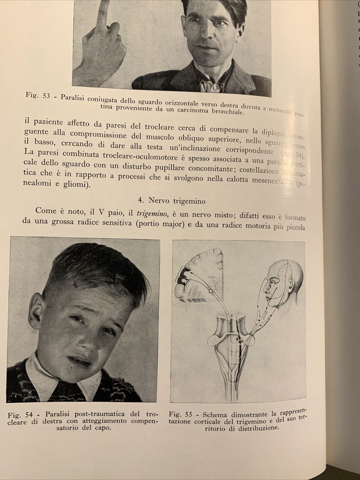 DIAGNOSI DIFFERENZIALE DELLE SINDROMI NEUROLOGICHE - BODECHTEL, ABRUZZINI 1961 #