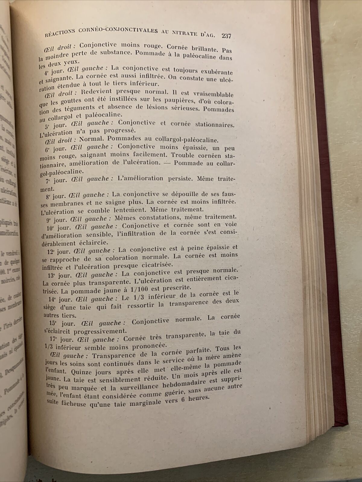 Bulletins et memoires de la société francaise d'ophtalmologie vol. XXXVI 1923