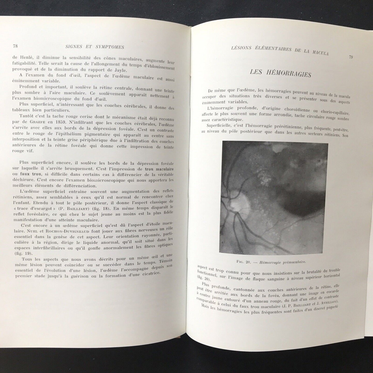 LES AFFECTIONS DE LA MACULA, Jean P. Bailliart - Masson & Cie