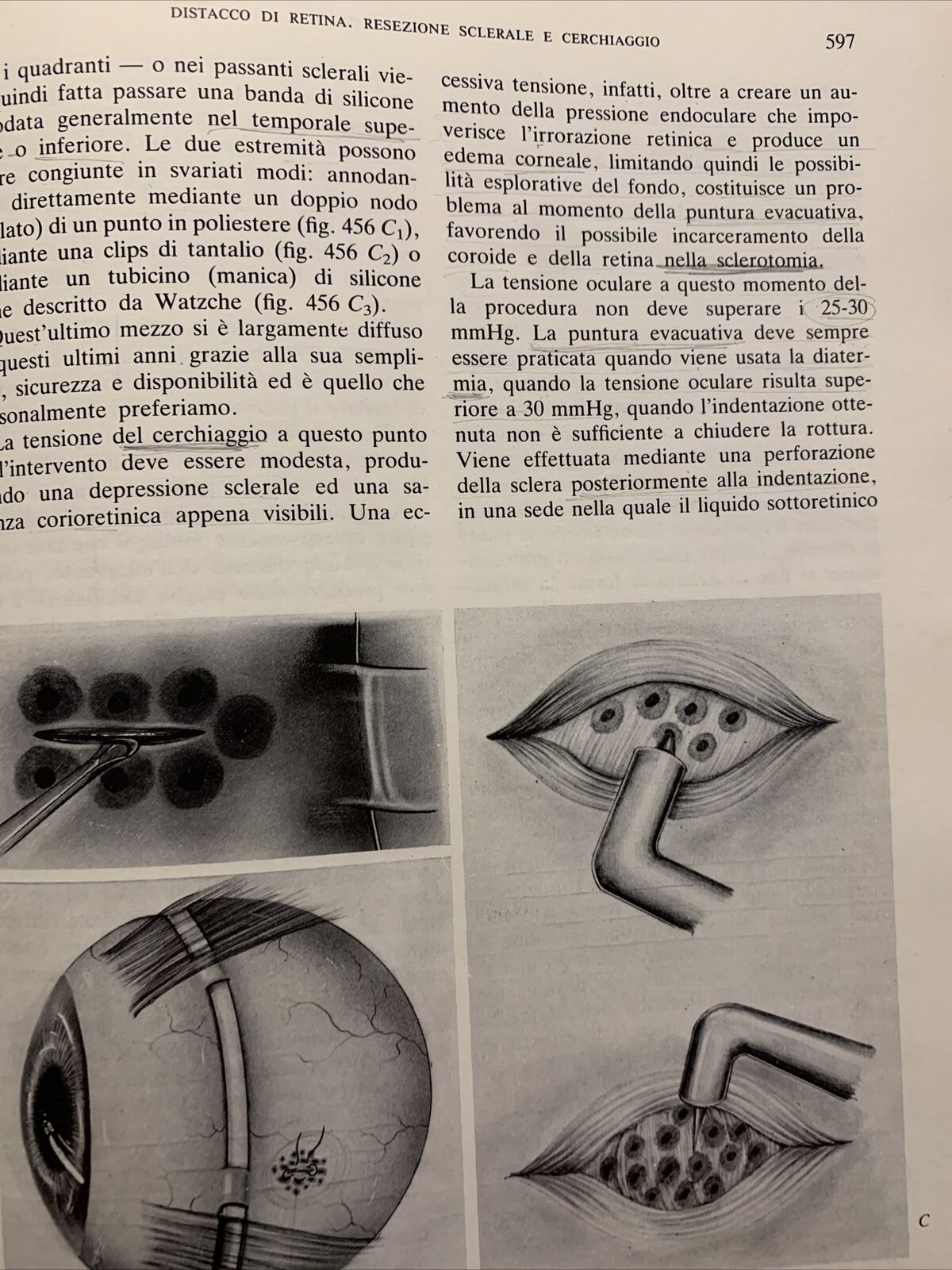 Tecnica Chirurgica. Chirurgia Oculistica UTET volume 10 - 1984 #
