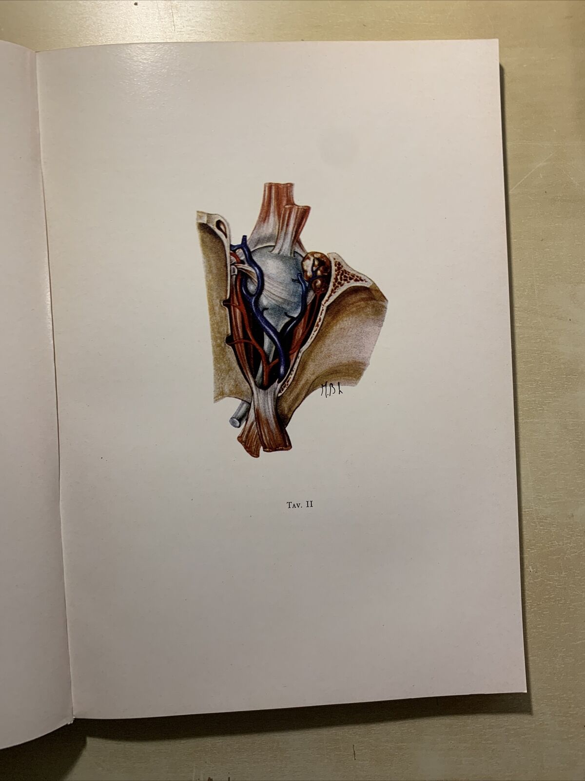 STATO ATTUALE DELLA FLEBOGRAFIA ORBITARIA - CRISTINI, CARAMAZZA, GIORDANO #