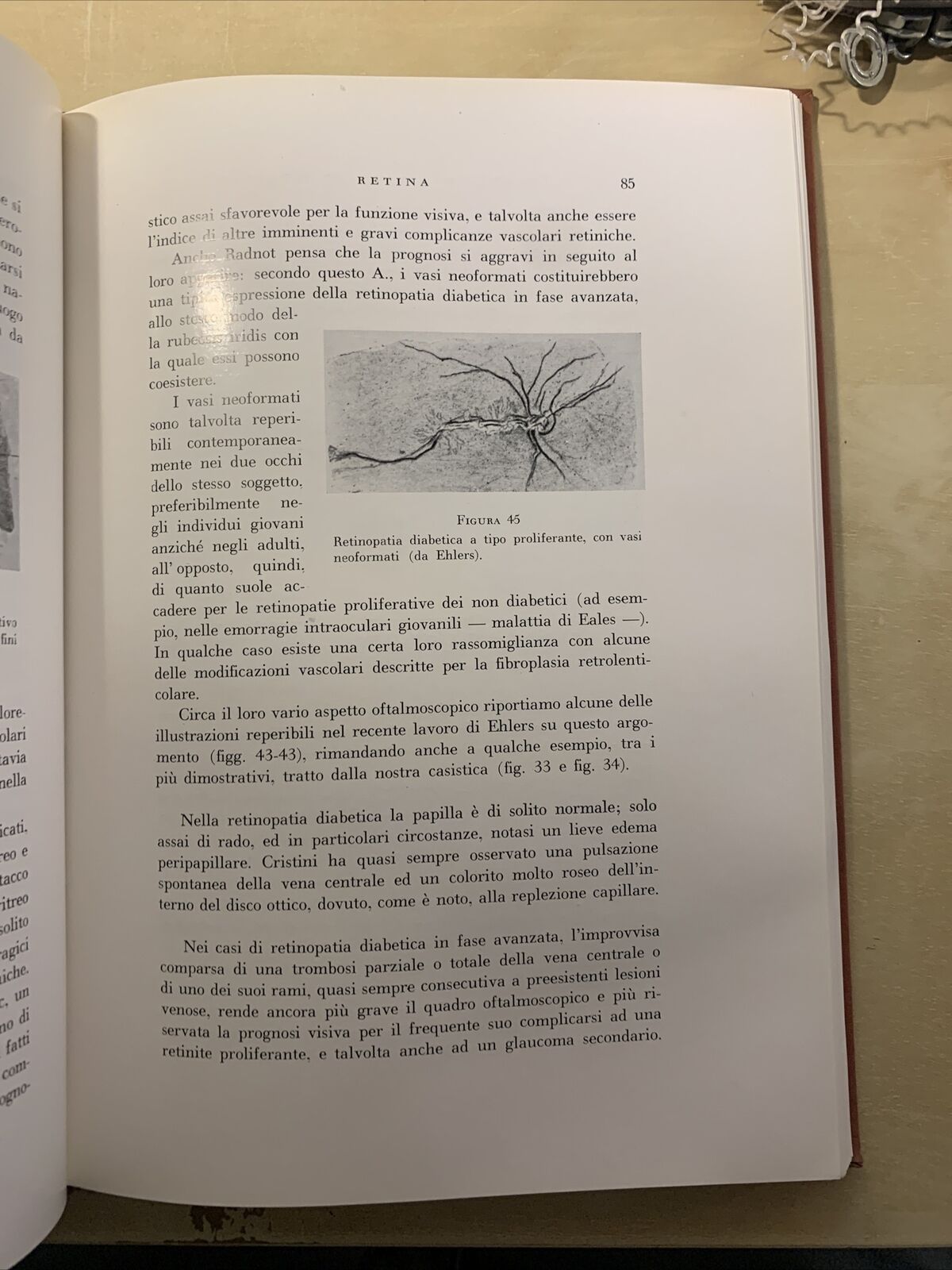 L'OCCHIO NEL DIABETE MELLITO - ALAGNA, SCULLICA, CASA EDITRICE G. D'ANNA 1956 #