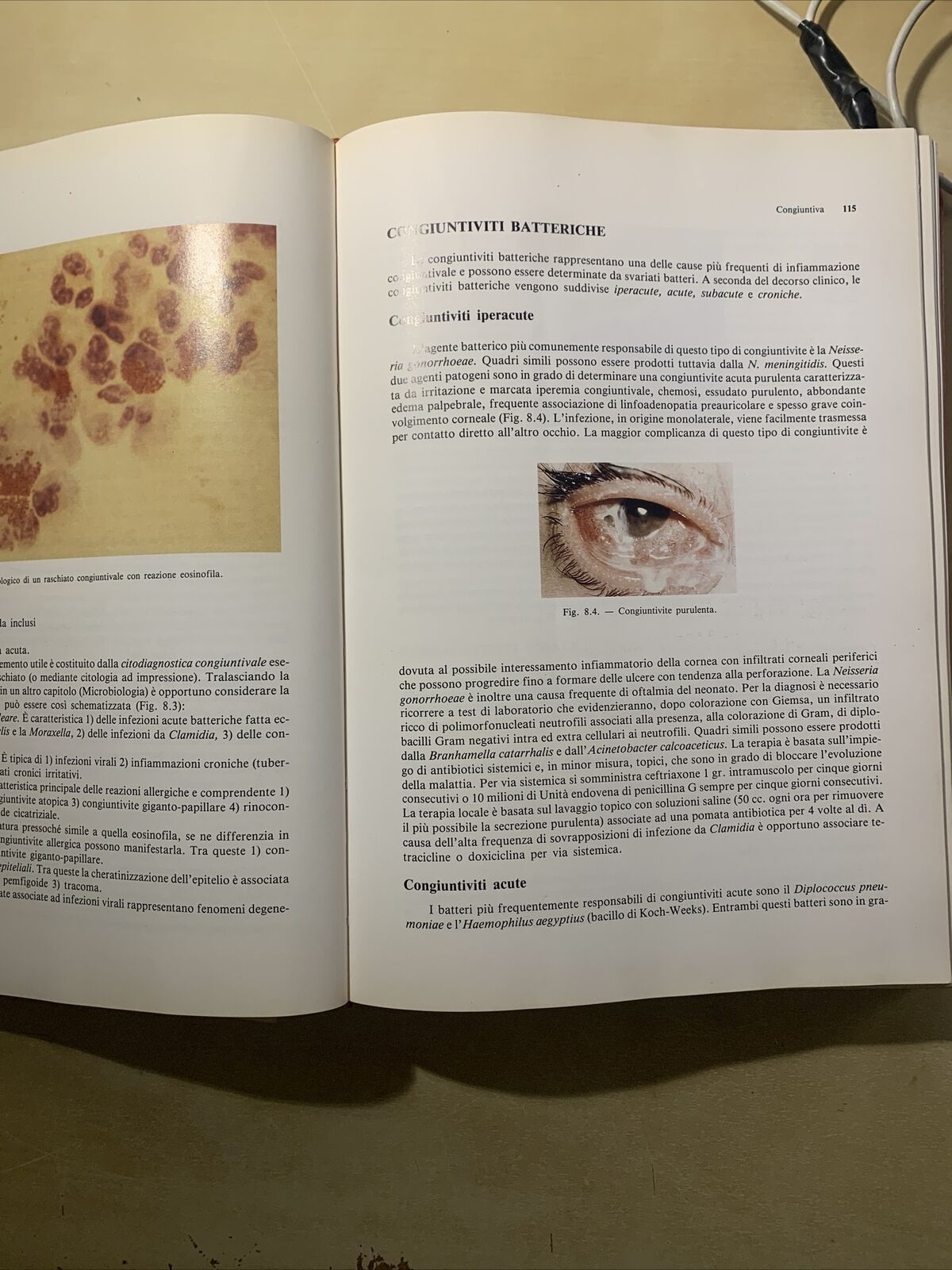 OFTALMOLOGIA - MASSIMO G. BUCCI. EDITRICE UNIVERSO 1993