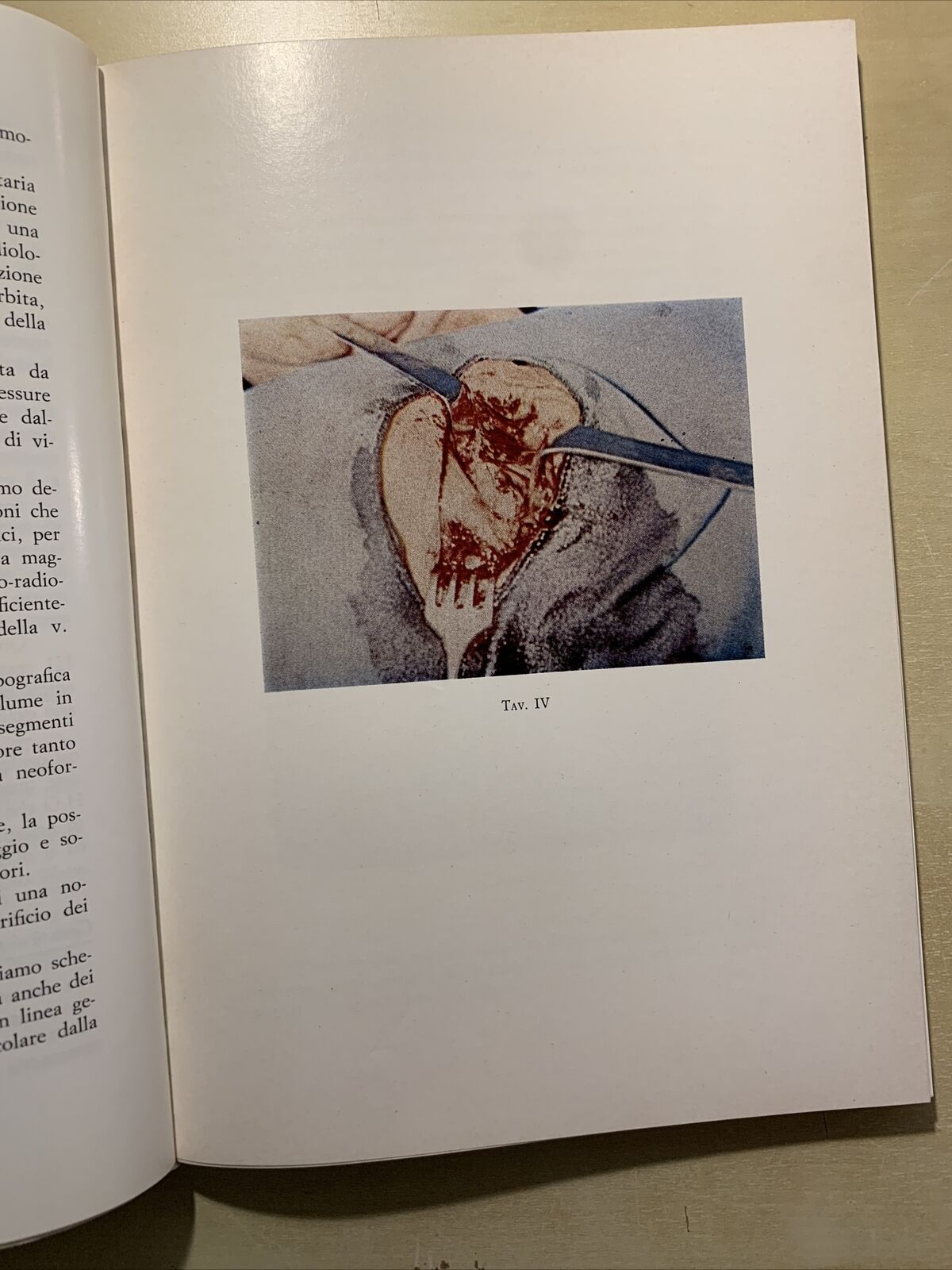 STATO ATTUALE DELLA FLEBOGRAFIA ORBITARIA - CRISTINI, CARAMAZZA, GIORDANO #