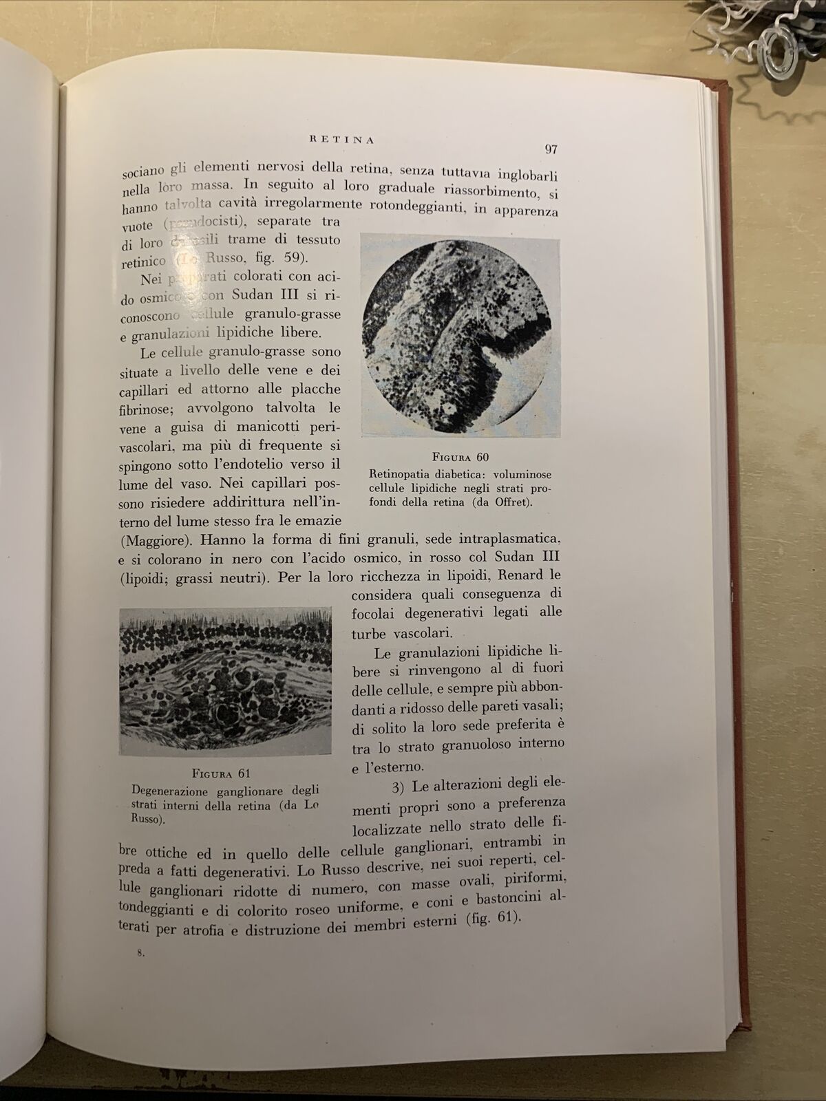 L'OCCHIO NEL DIABETE MELLITO - ALAGNA, SCULLICA, CASA EDITRICE G. D'ANNA 1956 #