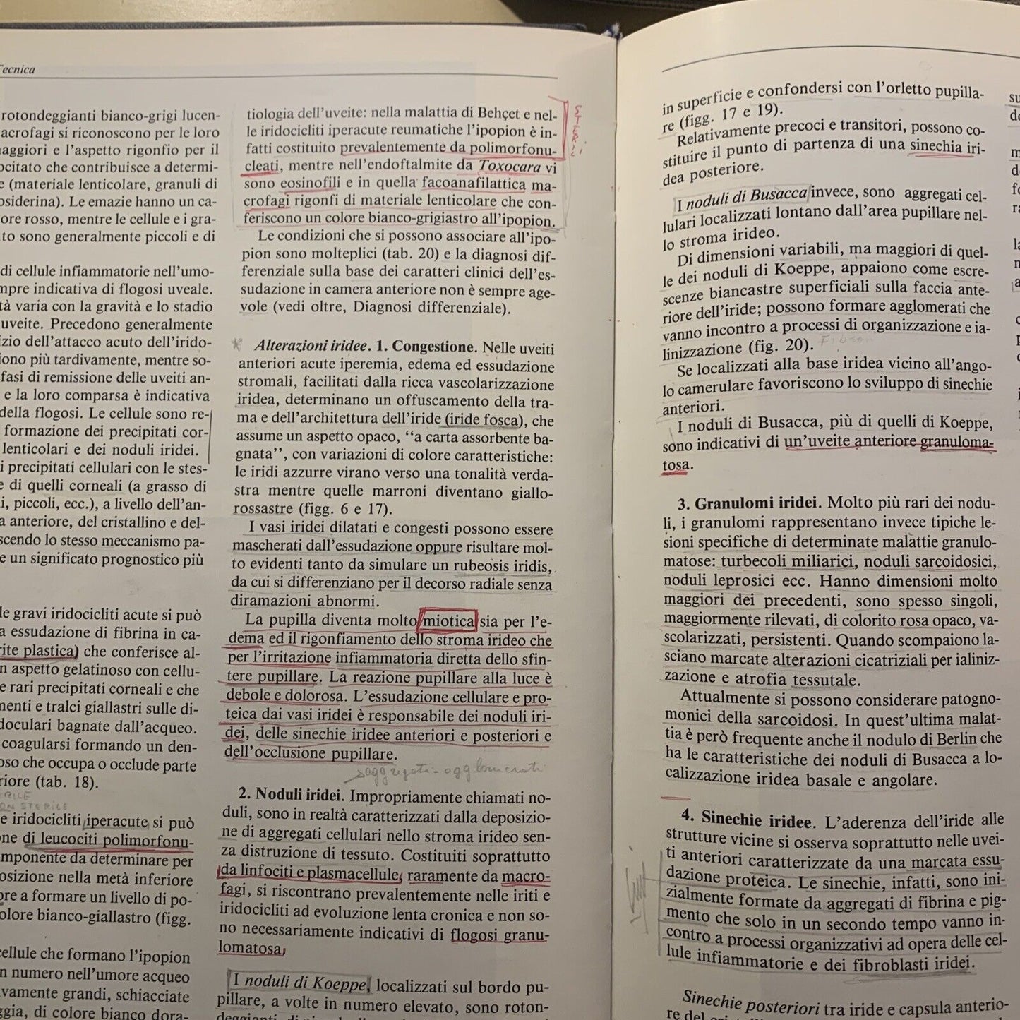 LE FLOGOSI UVEALI - PIVETTI PEZZI, MASSON 1987 #