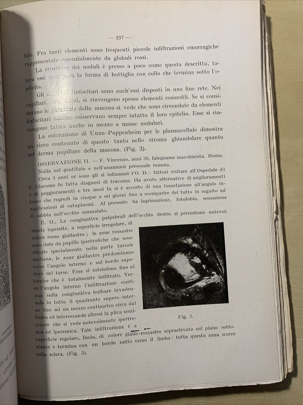 SAGGI DI OFTALMOLOGIA - clinica oculistica di Roma. Prof di Marzio 1927. vol 3 #