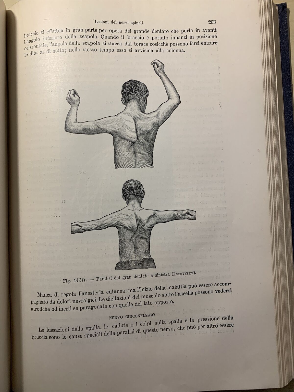 MANUALE PRATICO MEDICINA INTERNA - FEDERICO TAYLOR. UTET 1911. 2 VOLUMI #