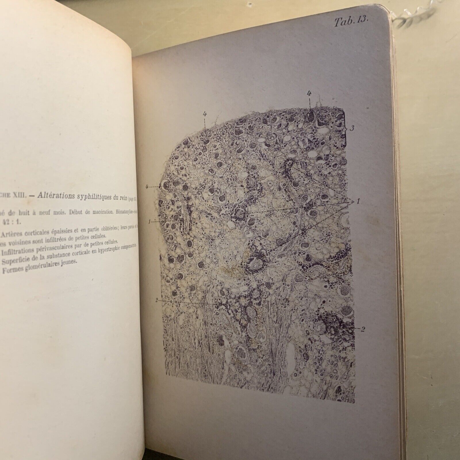 ATLAS MANUEL MALADIES DES ENFANTS. Hecker Trump Apert. Baillière & Fils 1906 #