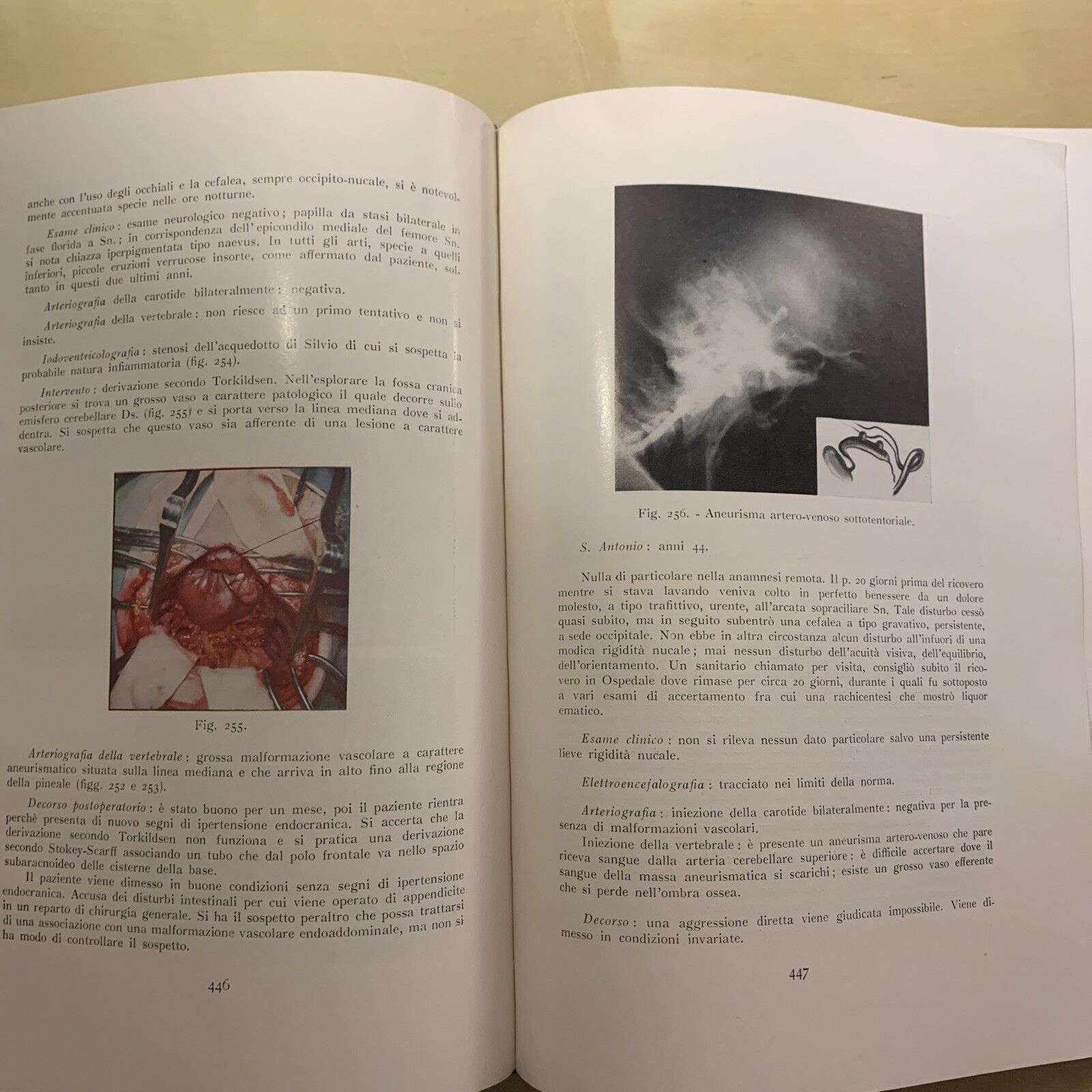 ANGIOGRAFIA CEREBRALE - MARIO MILLETTI, VOLUME PRIMO. LUIGI PARMA 1959