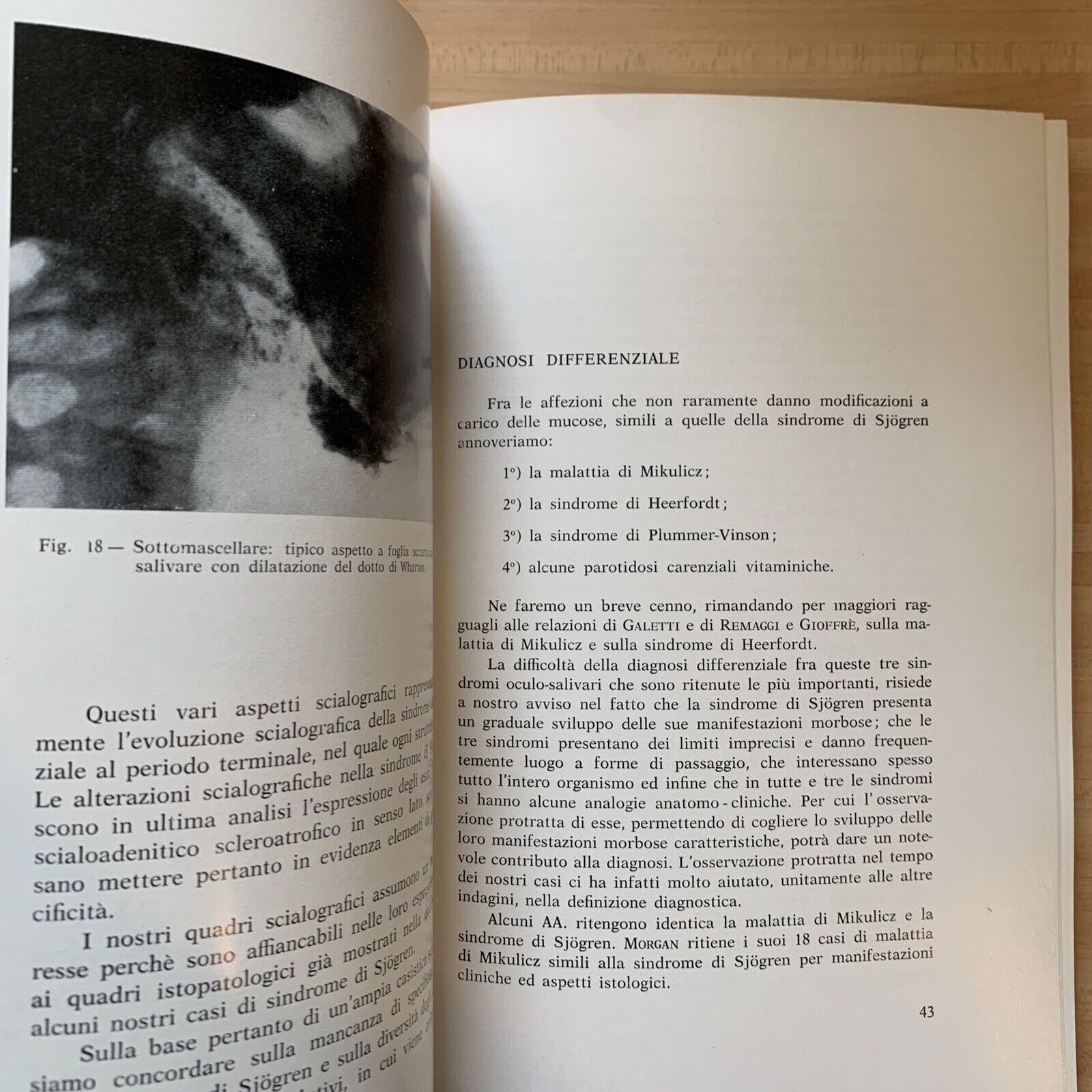 SINDROMI E MALATTIE OCULO SALIVARI - Remaggi, Lecco, Galetti. Toschi 1963