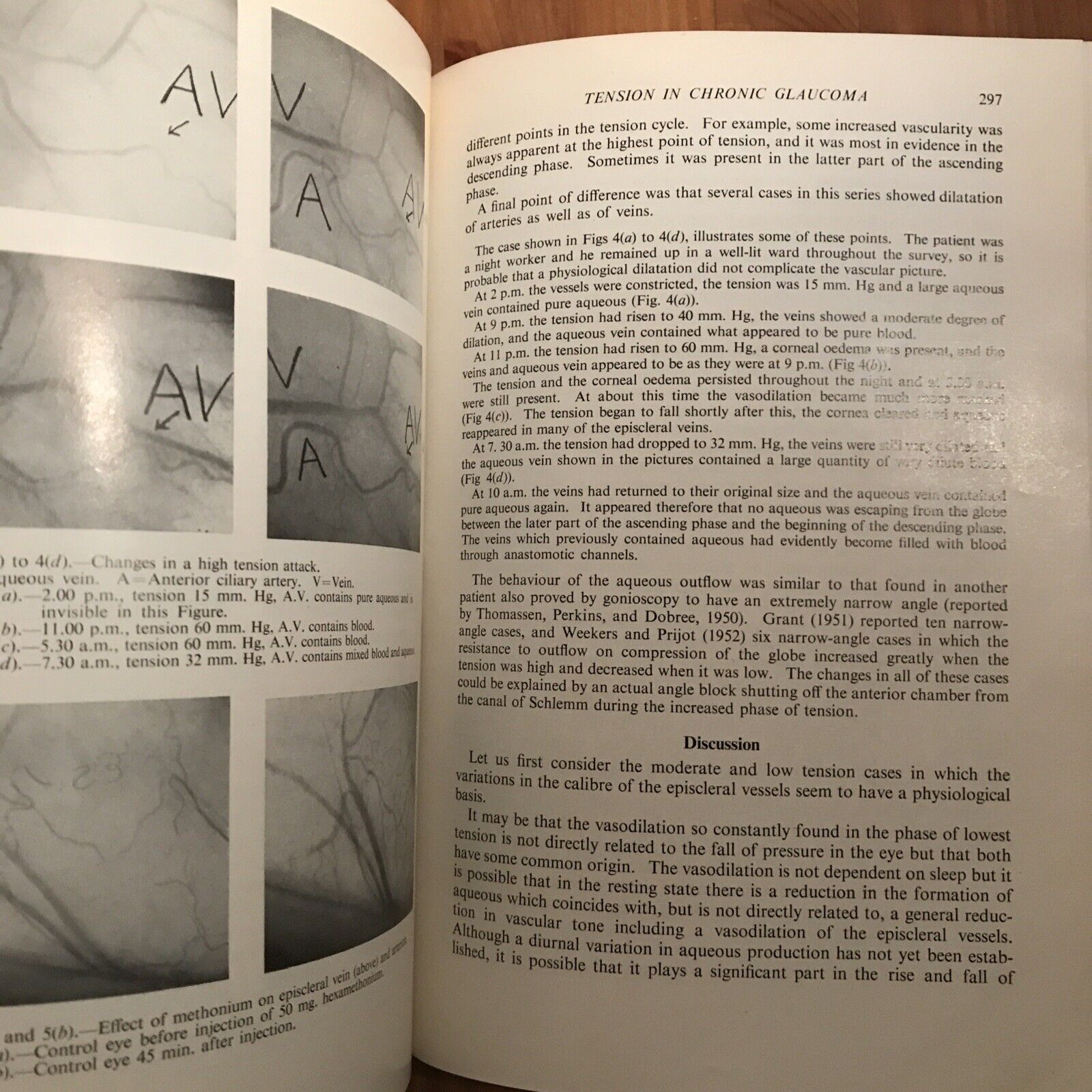 BRITISH JOURNAL OF OPHTHALMOLOGY oftalmologia, vol. XXXVII 1953 - S. Duke-Elder