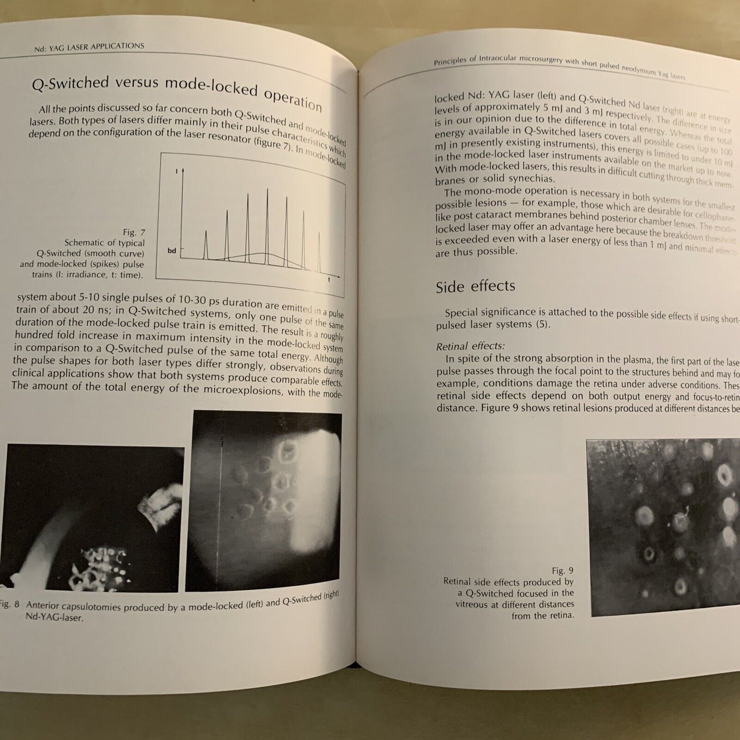ND: YAG LASER APPLICATIONS - LUCIO BURATTO. OFTALMOLOGIA - ophthalmology