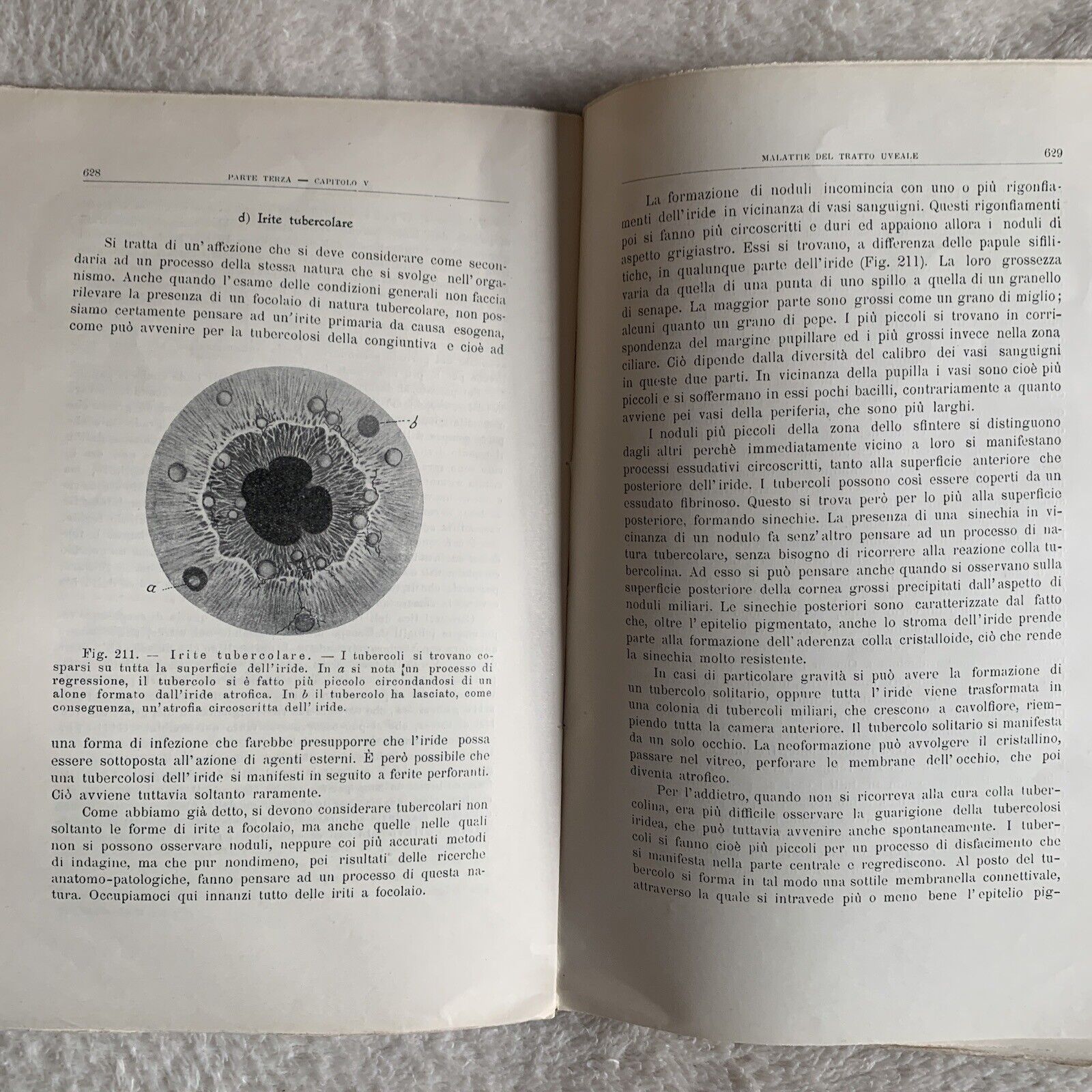 TRATTATO DI OFTALMOJATRIA. Amilcare Bietti, Vol. secondo puntata prima-seconda.