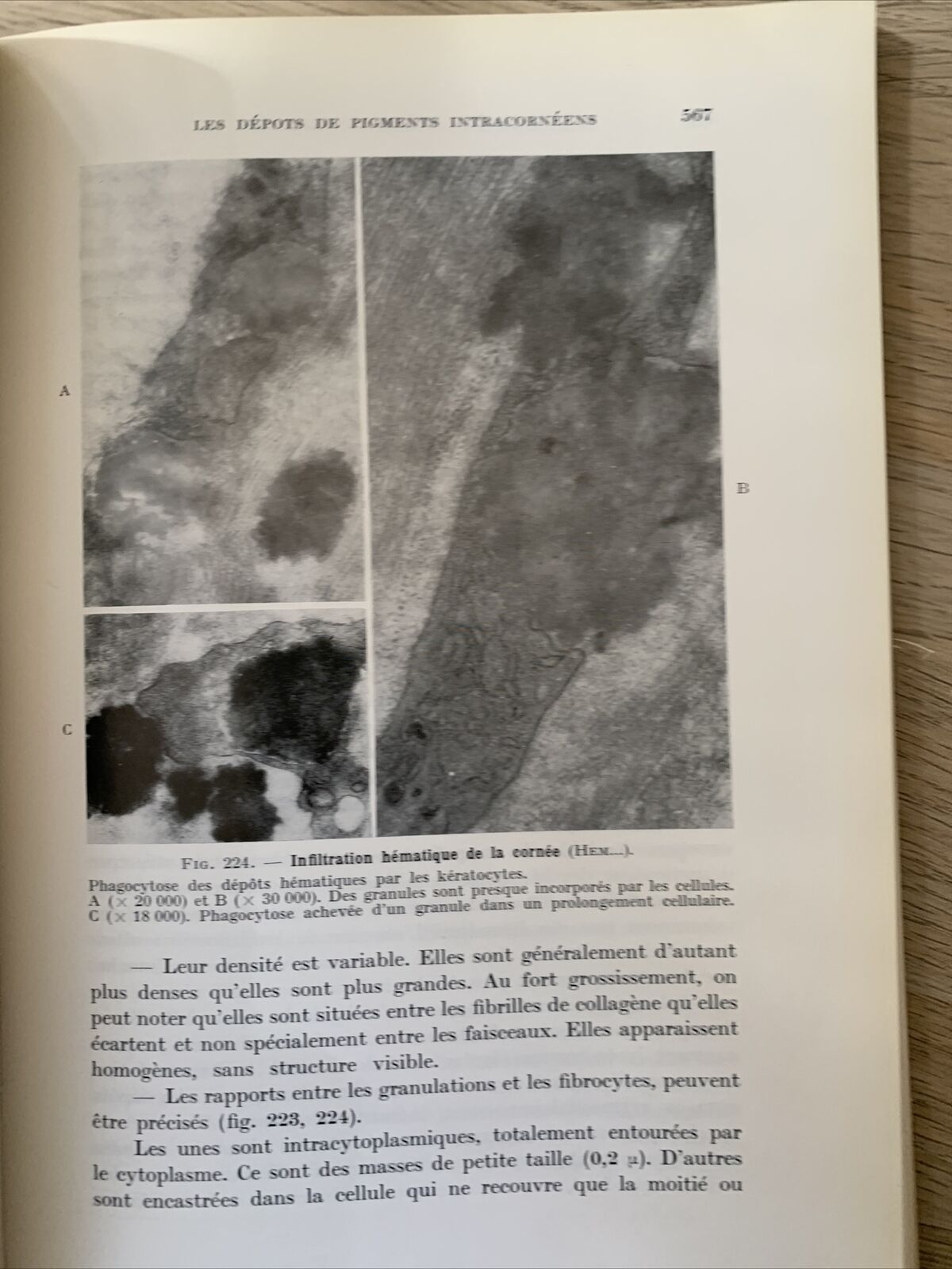 La Transparence de la Cornée, les Mécanismes de ses Altérations. Payrau 1967 #