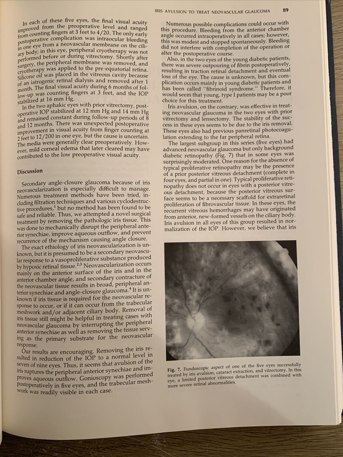ADVANCES IN VITREORETINAL SURGERY. G.B BIETTI. MARIO STIRPE 1992