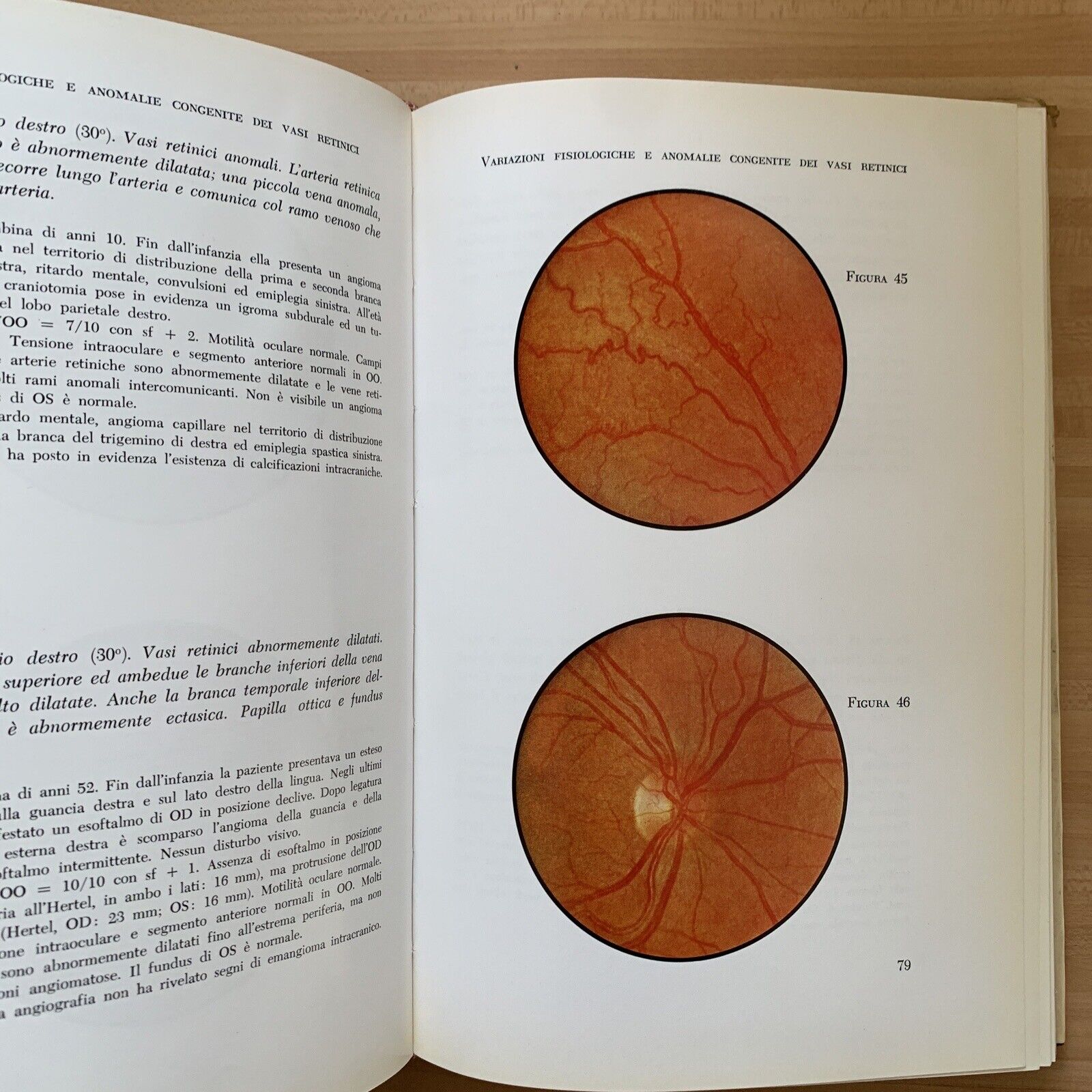 ATLANTE DEL FONDO DELL'OCCHIO - H. W. LARSEN. Luigi Russo editore 1964