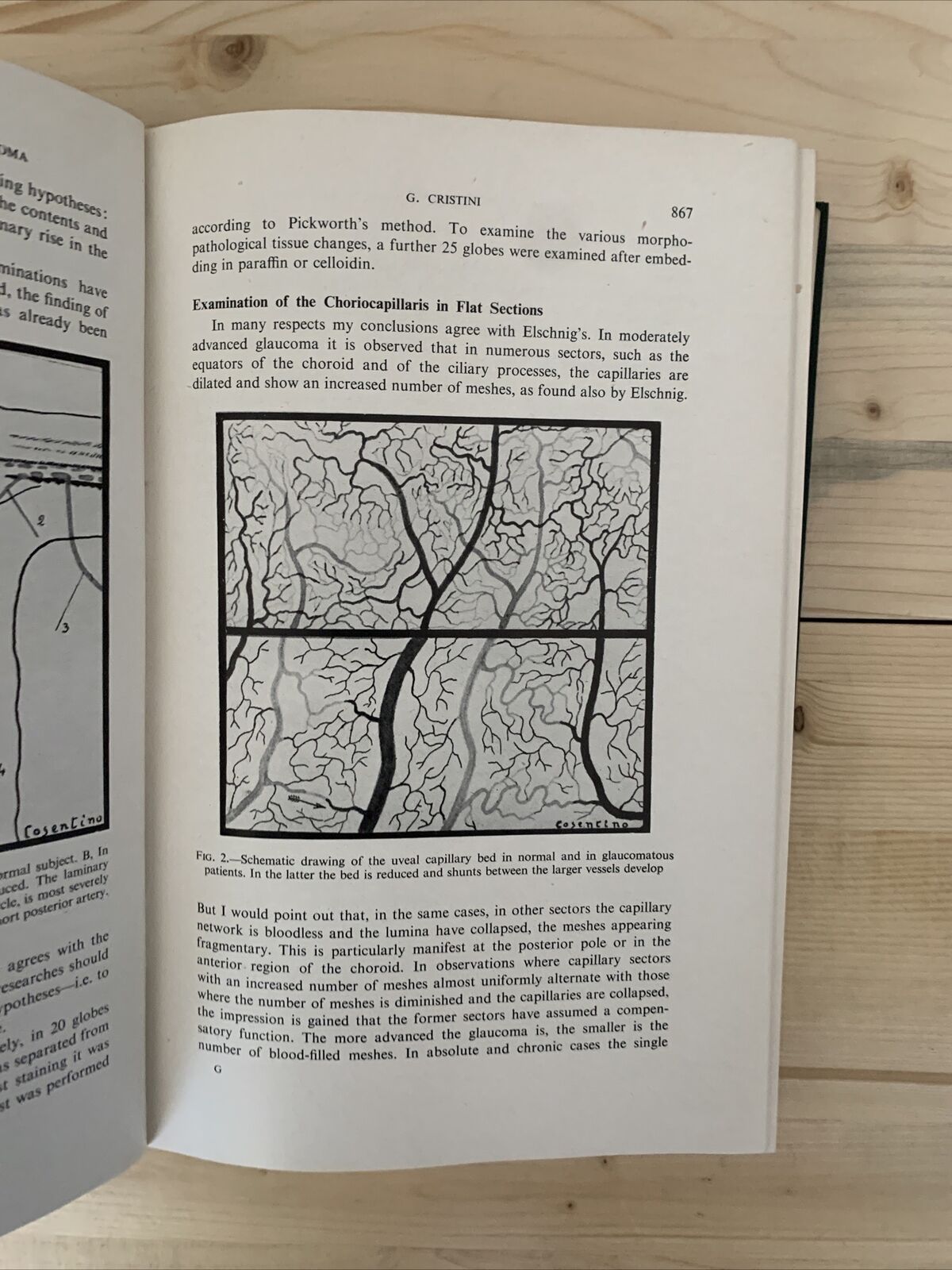 CONCILIUM OPHTHALMOLOGICUM XVI 1950 Britannia. Acta vol. II British Medical  #