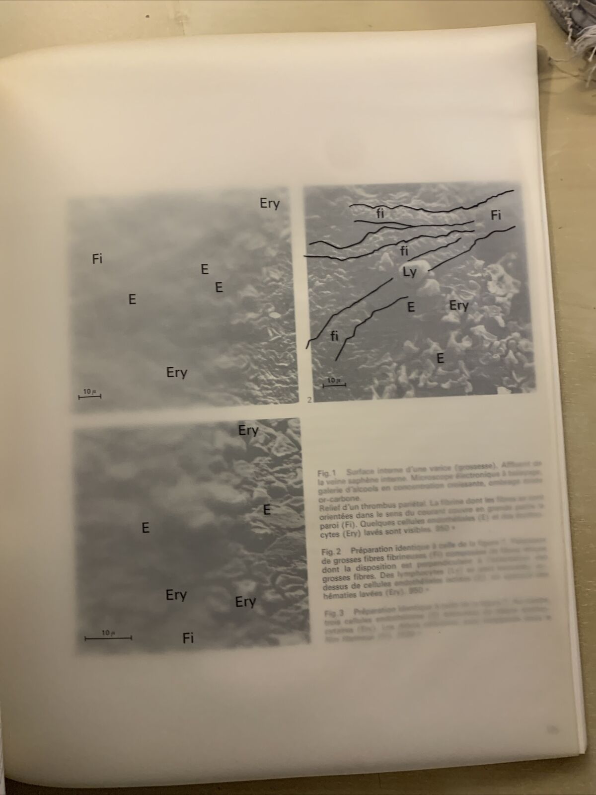 FORUM MEDICI - LES MÉDICINS PARLENT AU MÉDECIN, No 14 La phlébologie et les doma