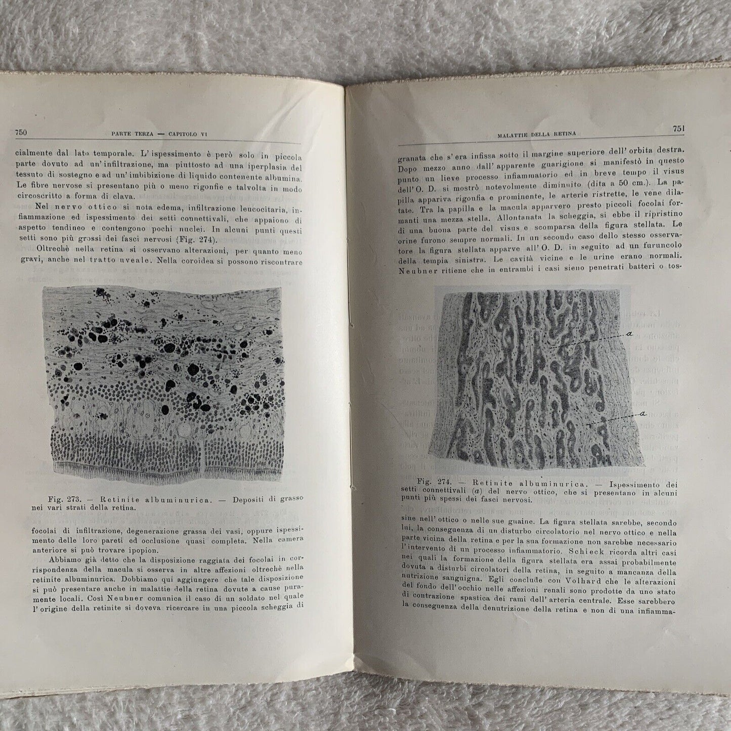 TRATTATO DI OFTALMOJATRIA. Amilcare Bietti, Vol. secondo puntata prima-seconda.