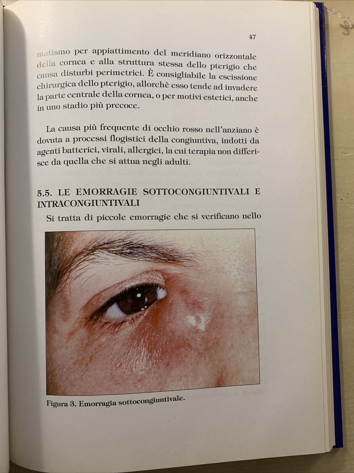 PATOLOGIA OCULARE NELL'ANZIANO - Arturo di Biase, di Benedetto. Pitagora 1995 #