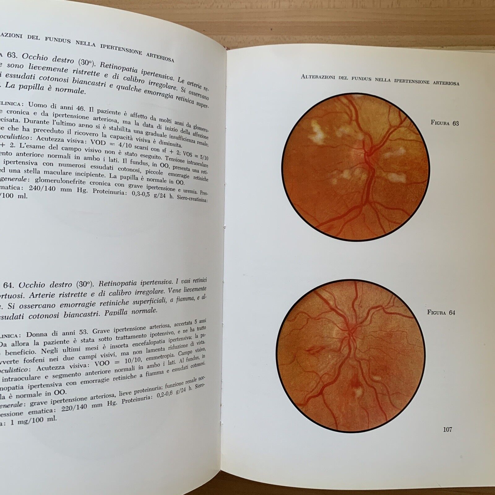 ATLANTE DEL FONDO DELL'OCCHIO - H. W. LARSEN. Luigi Russo editore 1964