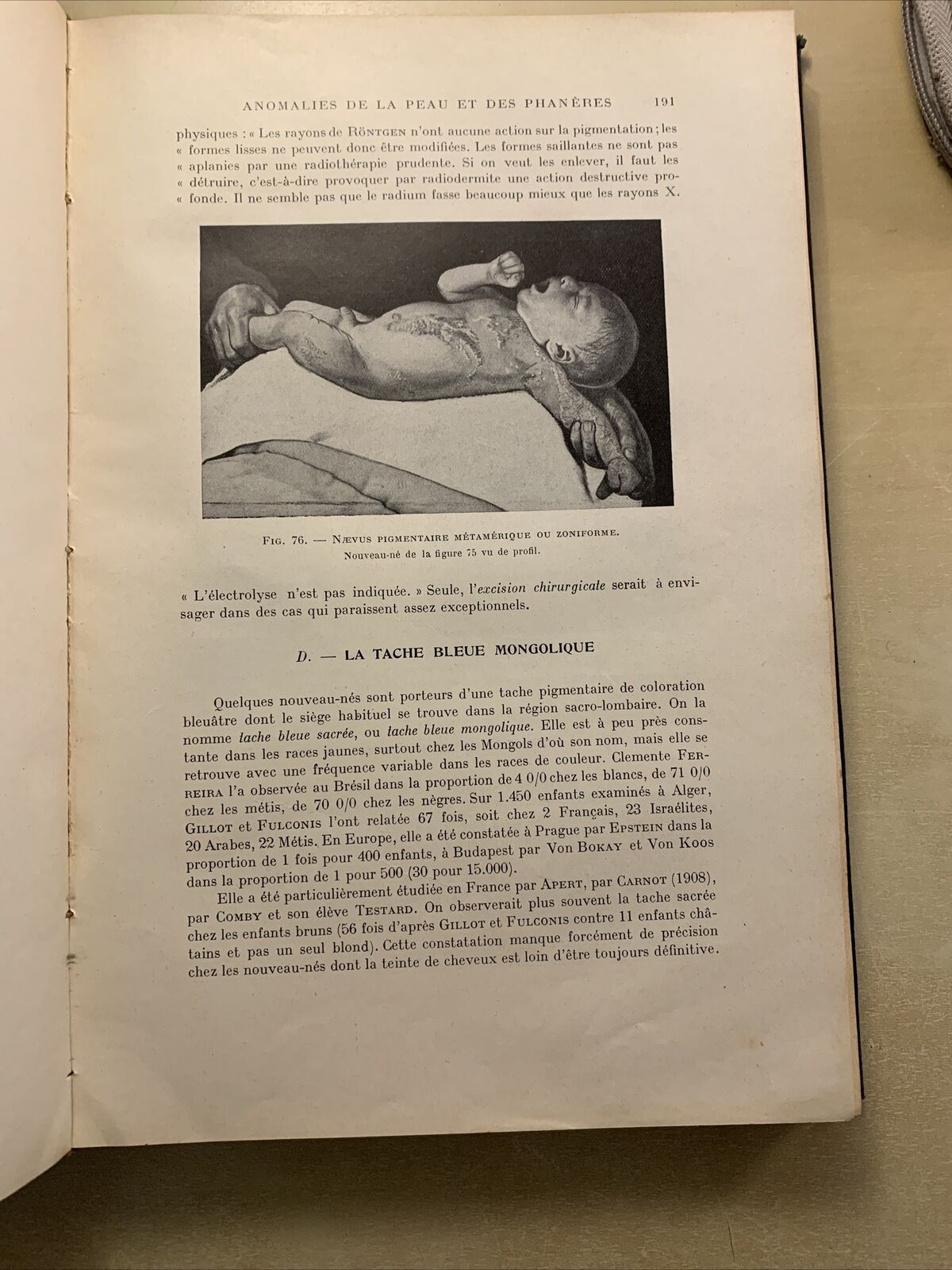 La pratique de l'art des accouchements V. A. Brindeau, Rhenter, Balthazard 1928