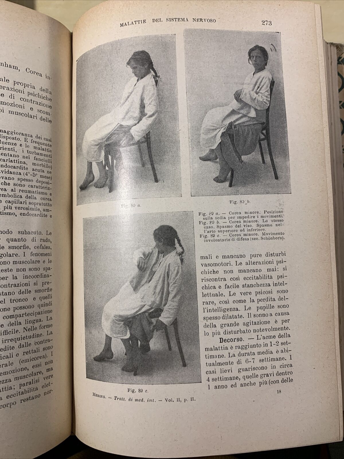 TRATTATO DELLE MALATTIE INTERNE, J. v. Mering. Società Editrice Libraria 1926