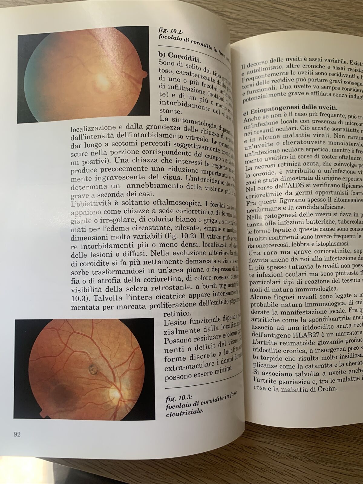 MANUALE PRATICO DI OFTALMOLOGIA - LUCIANO BONOMI, PROGEI EDITORI 1993 #
