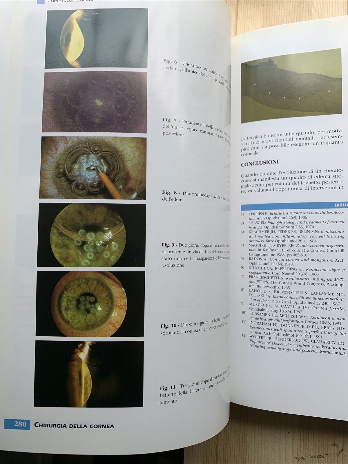 Chirurgia della Cornea - G. Rama, Società Oftalmologica Italiana. Fogliazza #