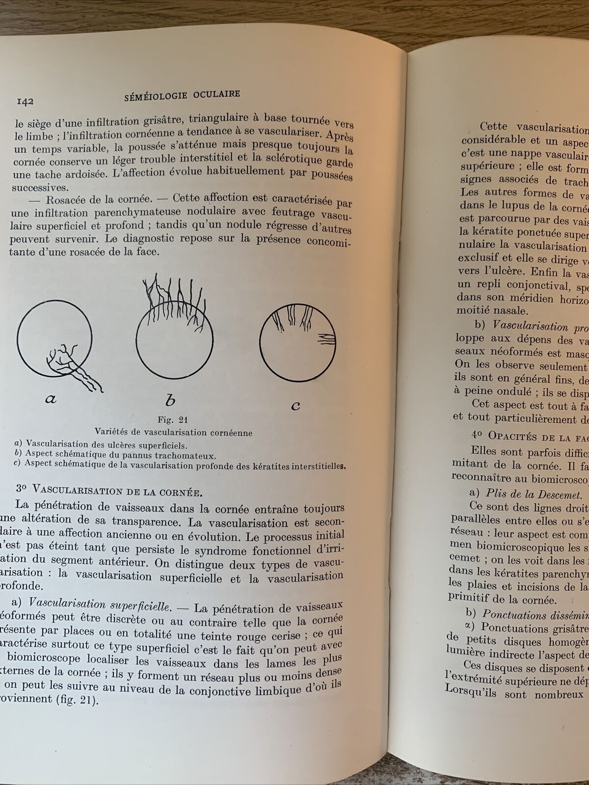 Abrégé de séméiologie oculaire, édouard Bessière. Bailliere 1954