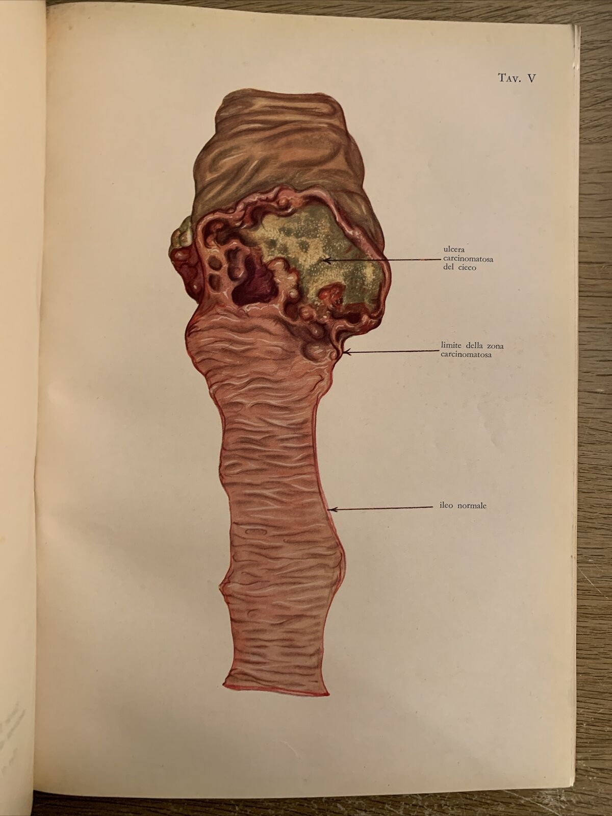 OPERAZIONI CHIRURGICHE. A. CIMINIATA. VOLUME TERZO. HOEPLI 1939