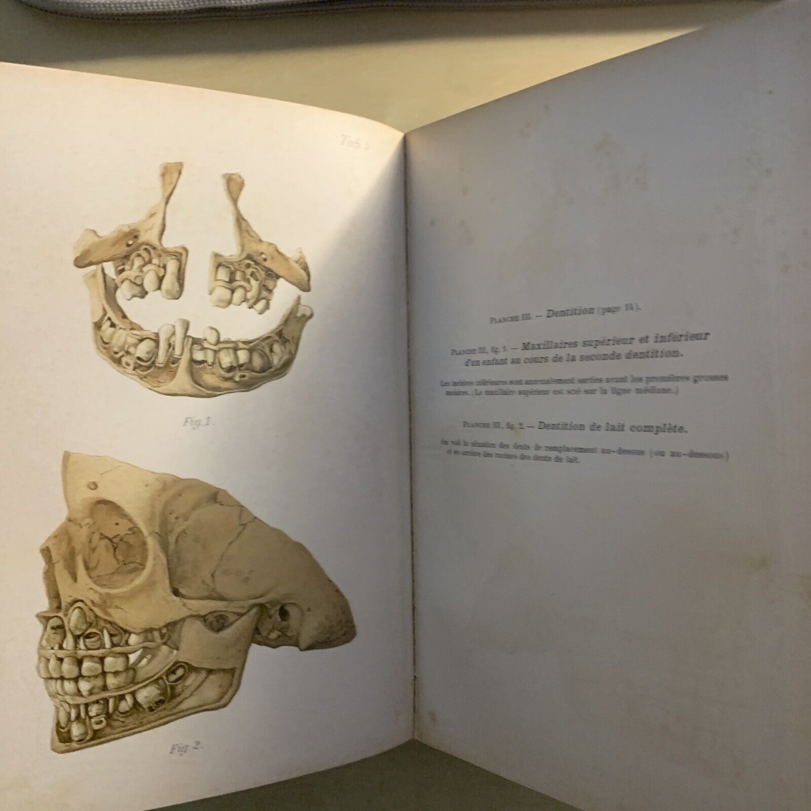 ATLAS MANUEL MALADIES DES ENFANTS. Hecker Trump Apert. Baillière & Fils 1906 #