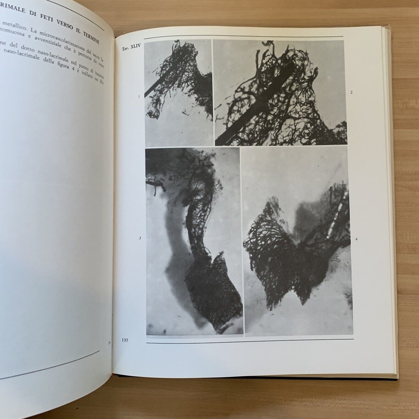 L'OCCHIO - parte terza volume primo. microvascolarizzazione. Morone, Ottaviani