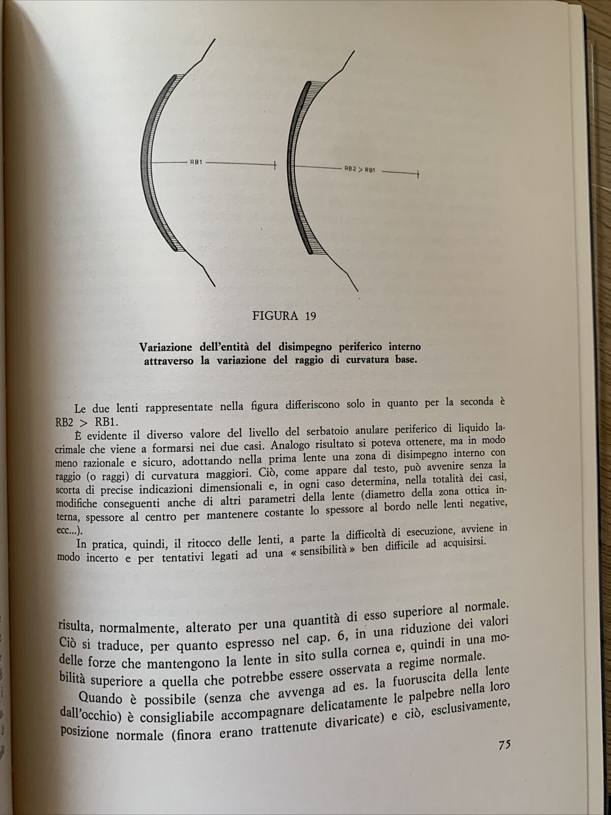 TECNICA E PRATICA DELLE LENTI A CONTATTO - ALDO ZOLDAN, REBELLATO EDITORE 1967 #