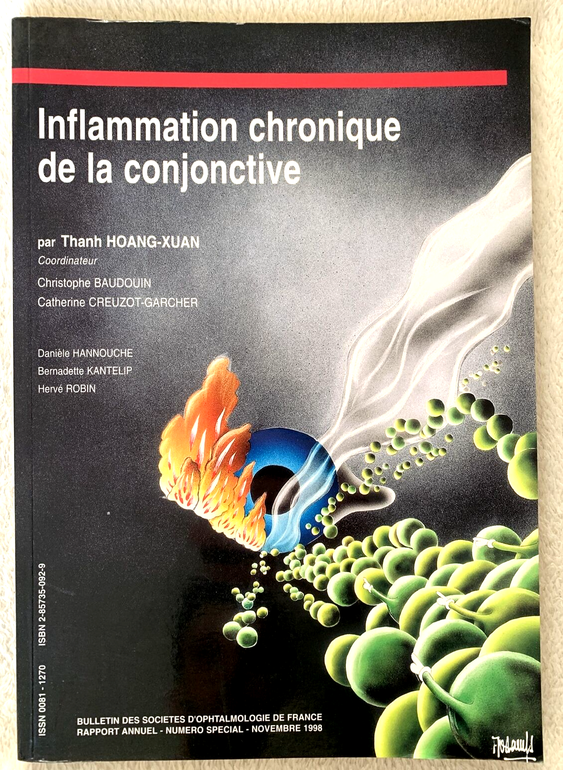Inflammation chronique de la conjonctive, Thanh Hoang-Xuan, Hannouche, Badouin