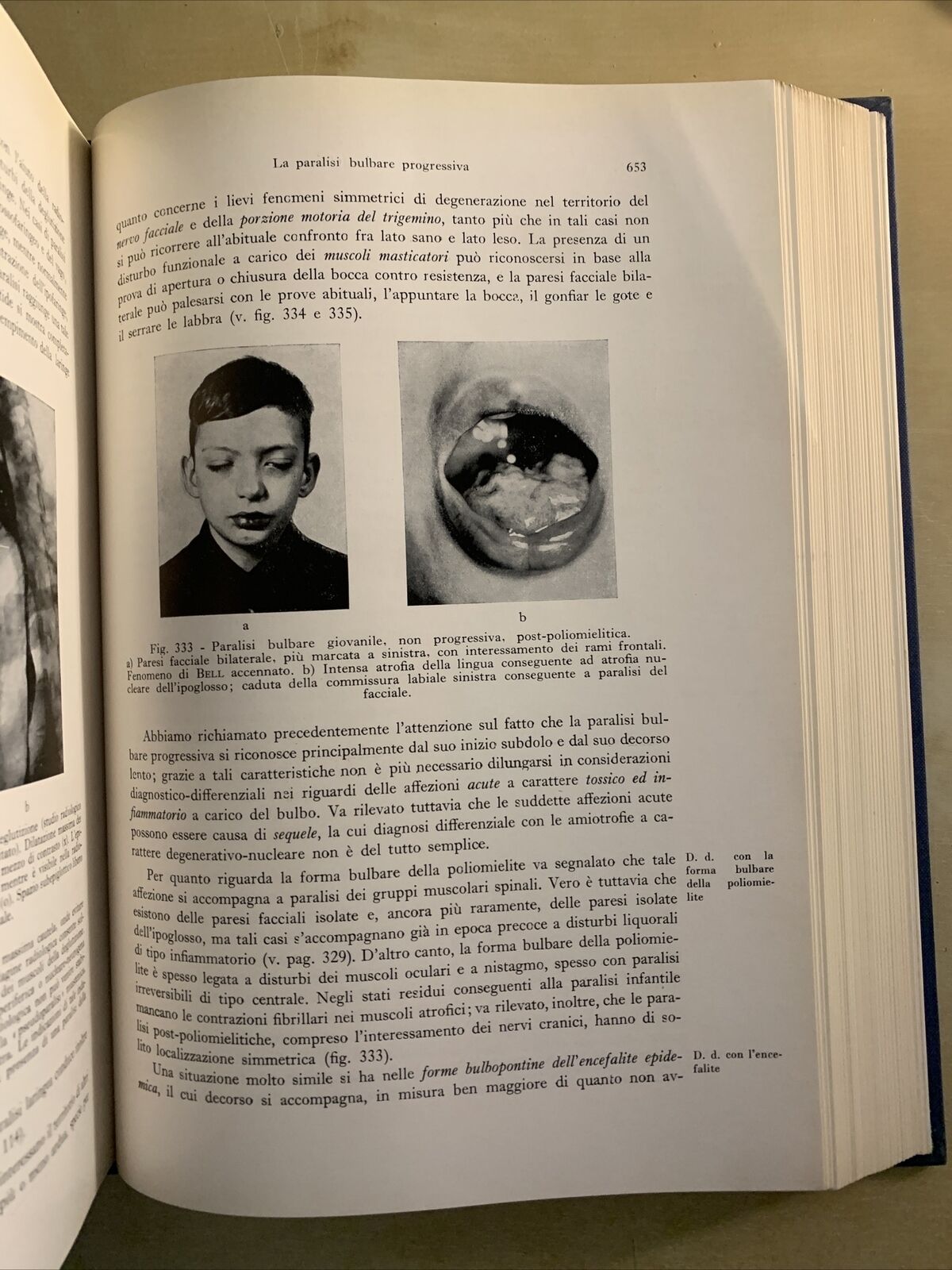 DIAGNOSI DIFFERENZIALE DELLE SINDROMI NEUROLOGICHE - BODECHTEL, ABRUZZINI 1961 #